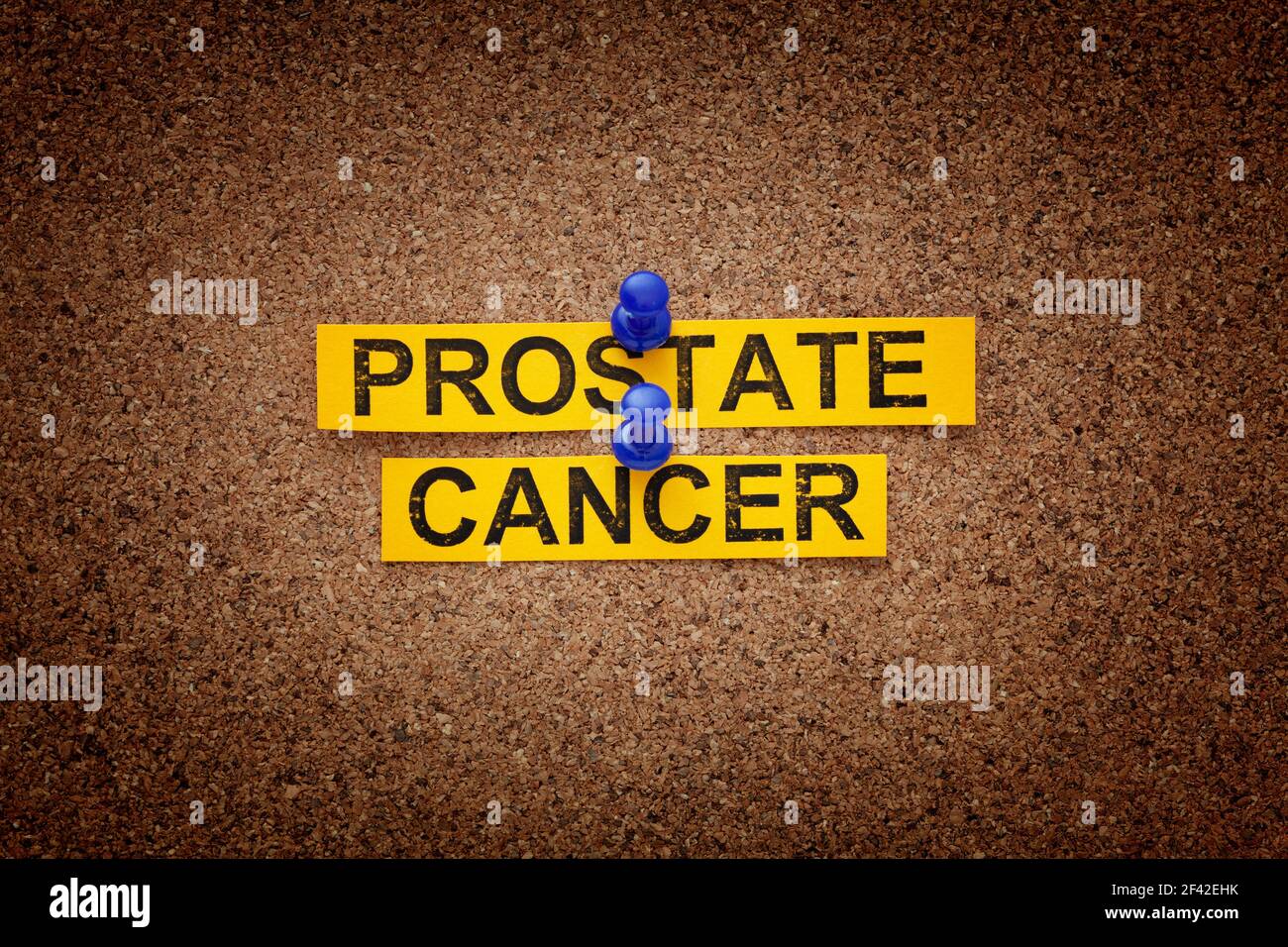 Le parole cancro della prostata su una tavola di sughero. Vignetta. Foto Stock
