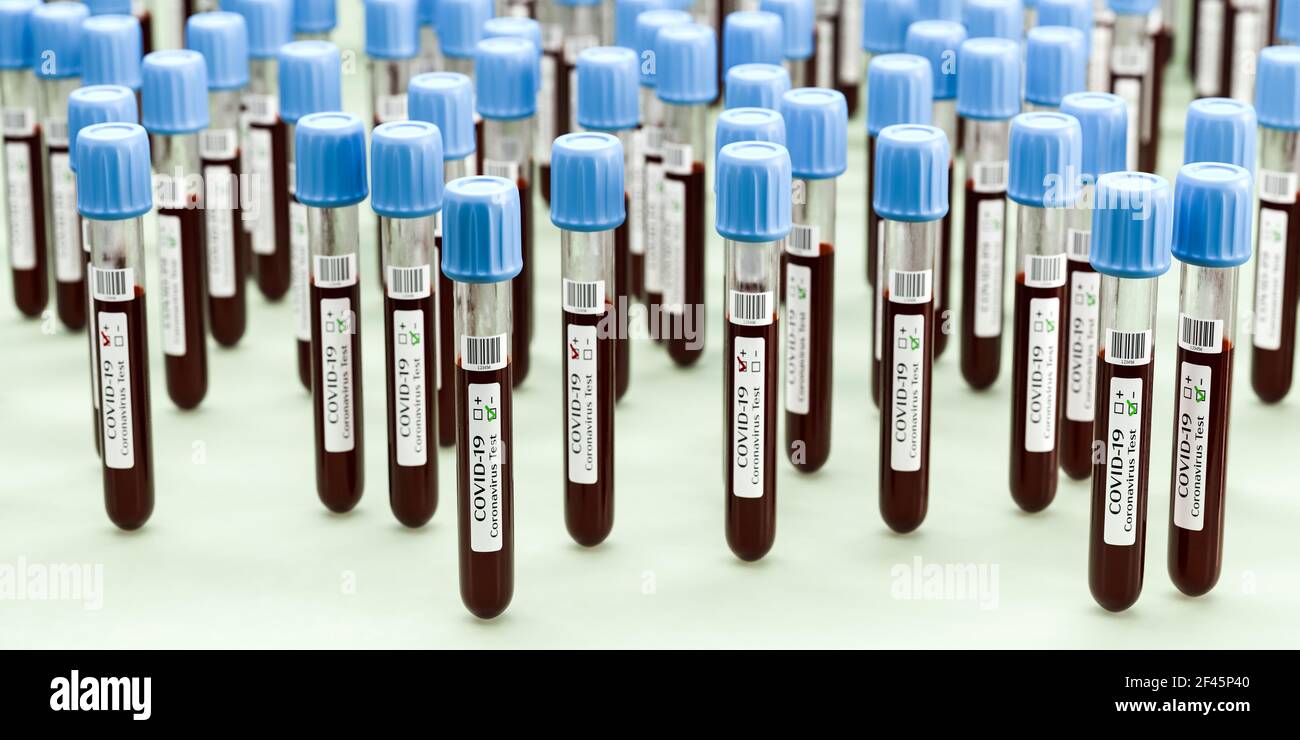 Provette con campioni di sangue con virus corona per analisi del sangue. Alcuni test in primo piano hanno segnato positivo, più negativo. Messa a fuoco selettiva. Foto Stock