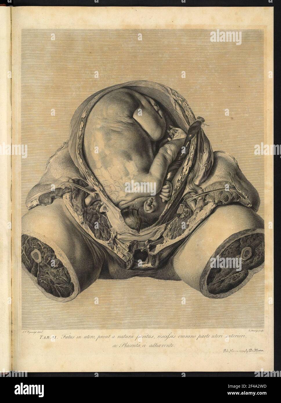 Fötus im utero. TAT. 6 aus: William Hunter, anatomia umana pancia incinta / compressa illustrare. 1774 Dresda SLUB 3294 001 20002 Foto Stock