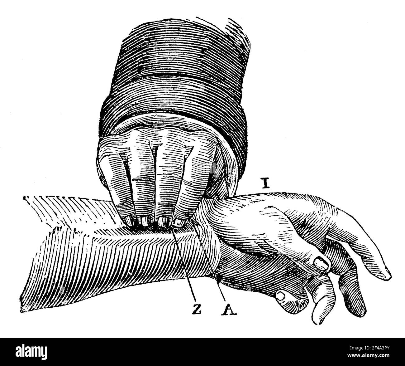 Sentire il polso. Illustrazione del 19 ° secolo. Germania. Sfondo bianco. Foto Stock