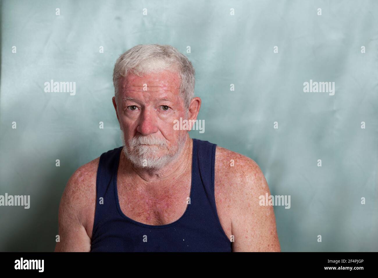 Un vecchio uomo caucasico vestito da una singoletta blu, con un sacco di danni al sole e tumori della pelle e una grumpia espressione arrabbiata sul viso. Foto Stock