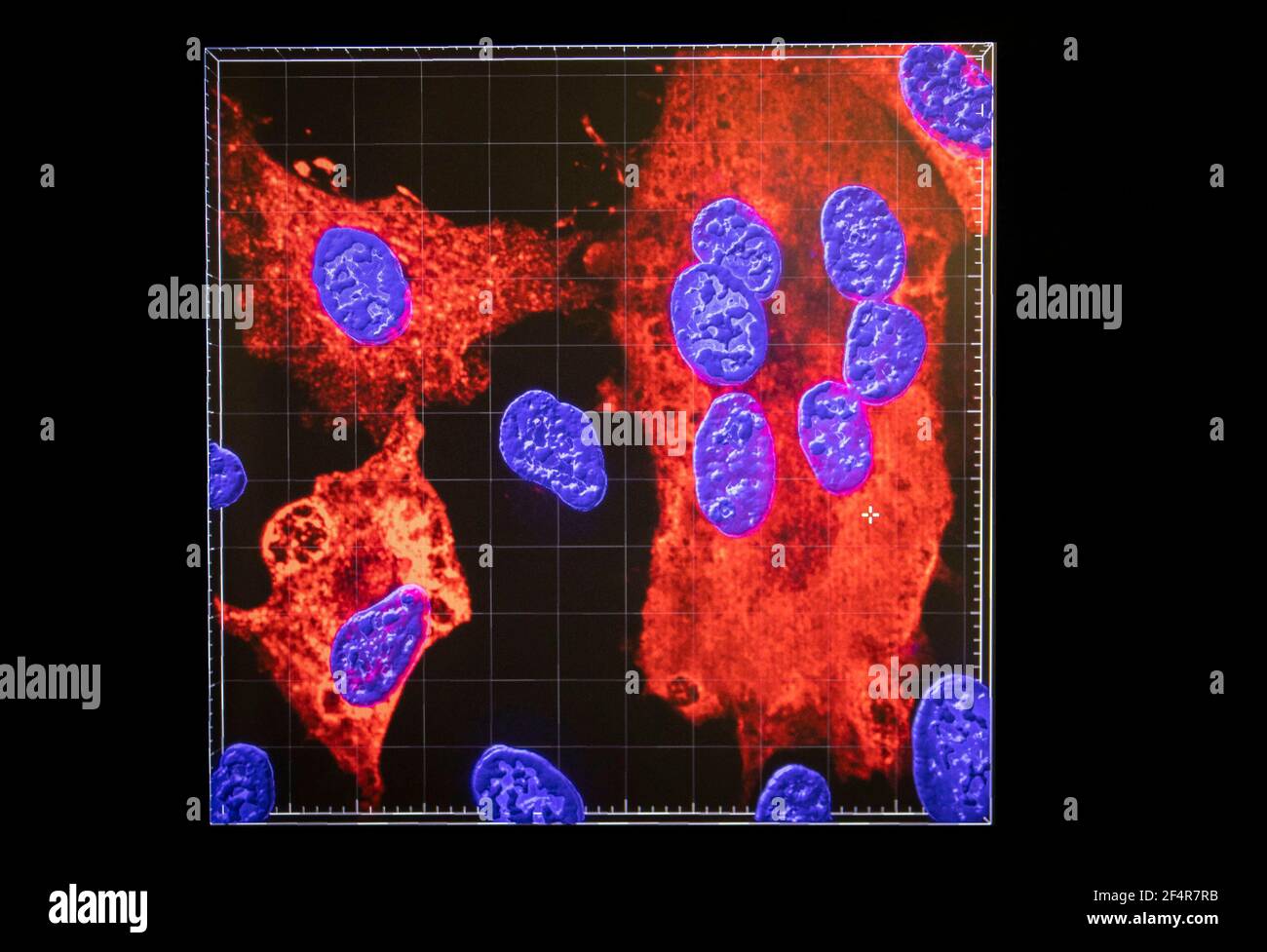 Un'immagine creata con un microscopio confocale mostra nuclei cellulari (blu) infettati da SARS-COV-2 (aree rosse), il virus che causa COVID-19, nei Richard Elliott Biosafety Laboratories (REBL), strutture di contenimento di livello 3, presso il Centro MRC-University of Glasgow per la Ricerca sui virus. Data immagine: Martedì 16 marzo 2021. Foto Stock