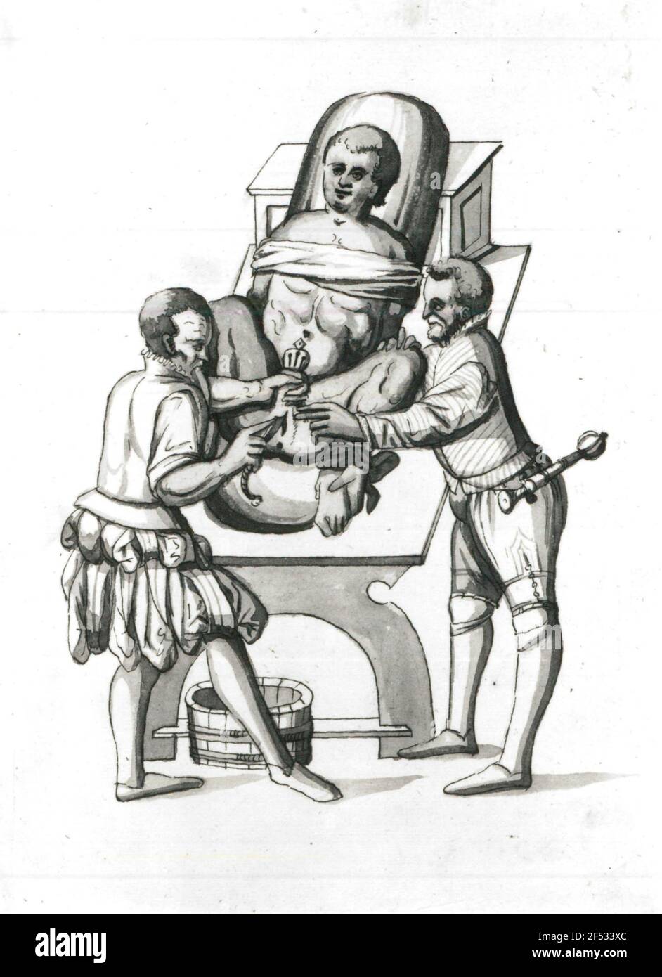 Taglio di pietra (chirurgia di pietra vescicale di un paziente ceduto da medico con assistente). Disegno, assaggiato; 18.5 x 13.5 cm. Da: BARTIC, GEORG, il libro d'arte è l'intero rapporto completo della pietra della vescica, Dresda, 1575. Dresda, arbusti MSCR.DRESD.C. 291 Foto Stock
