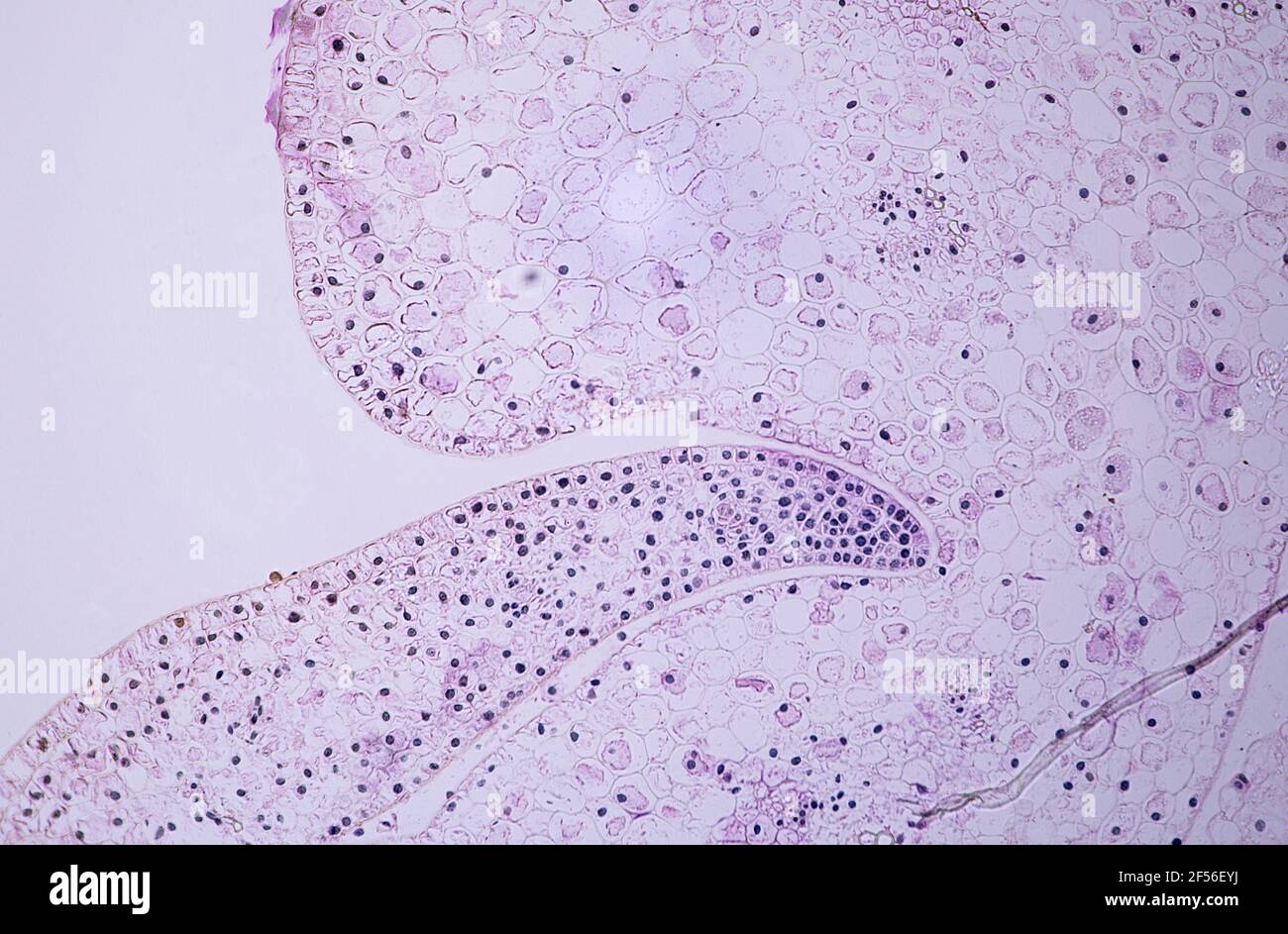 Vetrino microscopico immagini e fotografie stock ad alta risoluzione ...