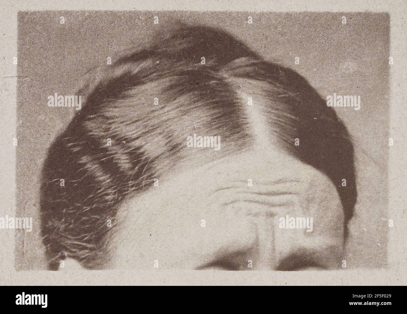 Il muscolo di dolore. Henry Thomas Melville (inglese, circa 1833 - 1878) Foto Stock