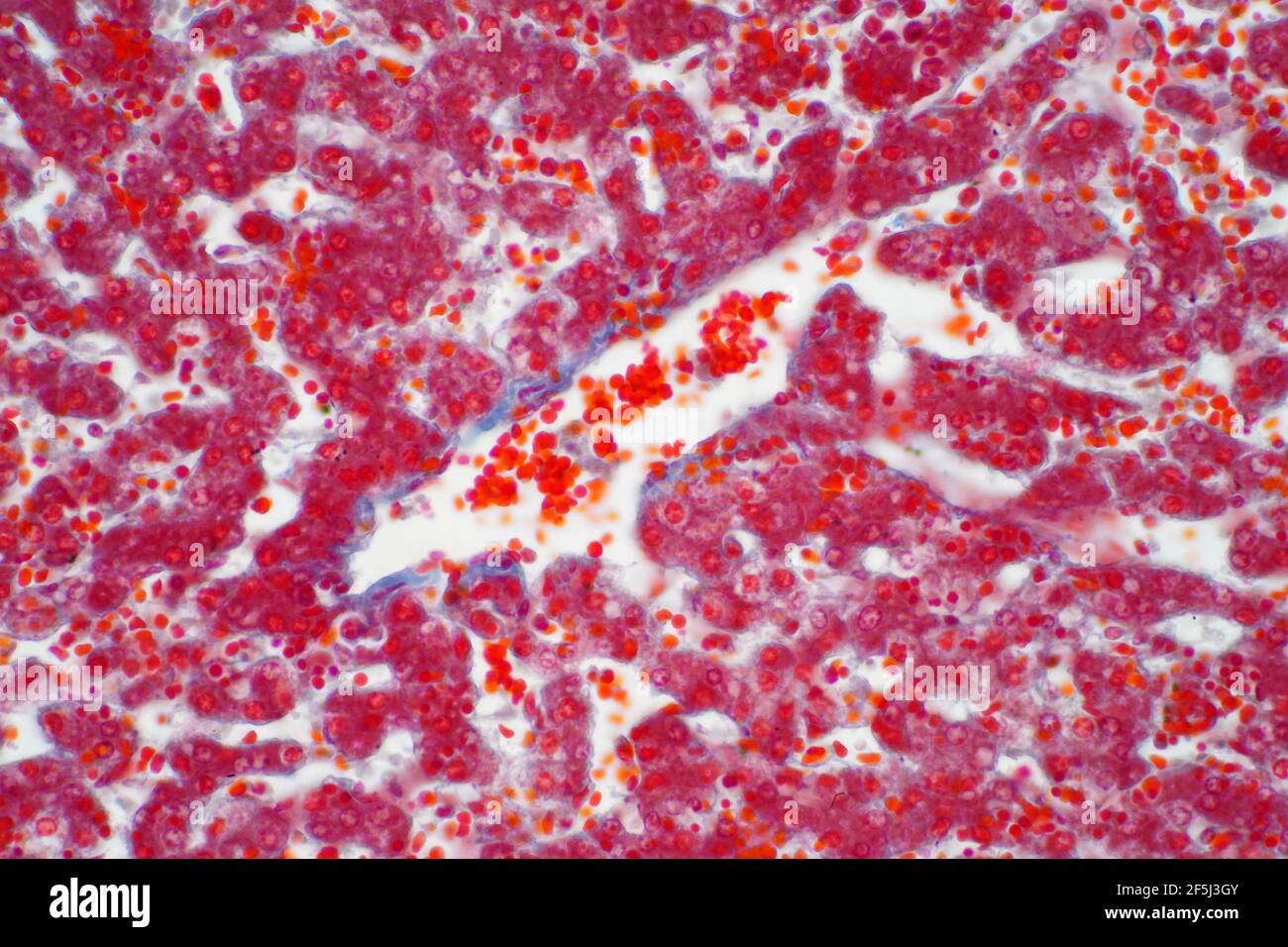 Tessuto epatico umano, micrografia leggera Foto Stock