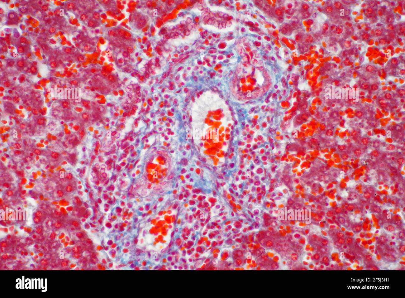 Tessuto epatico umano, micrografia leggera Foto Stock