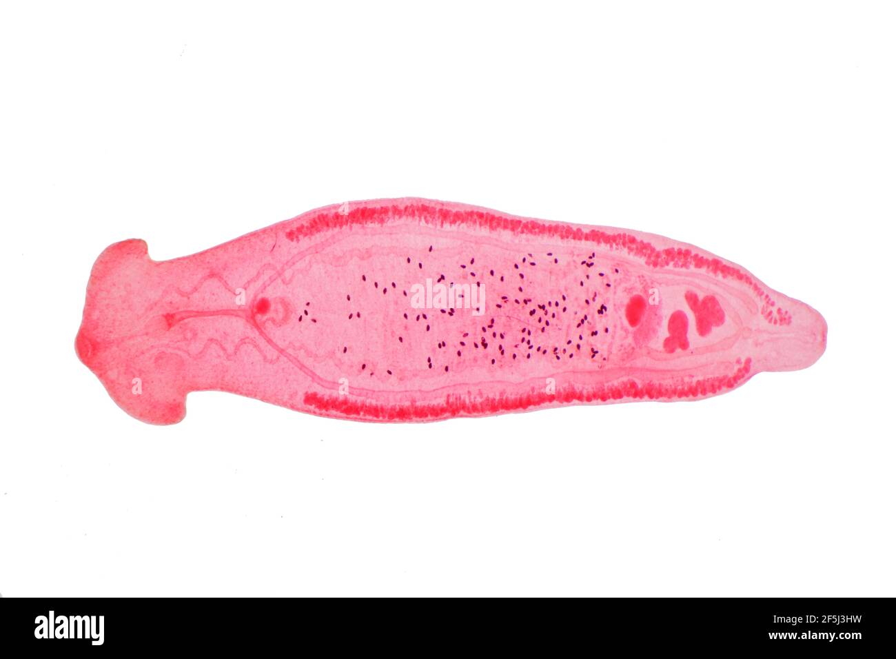 LIVER fluke, micrografia leggera Foto Stock