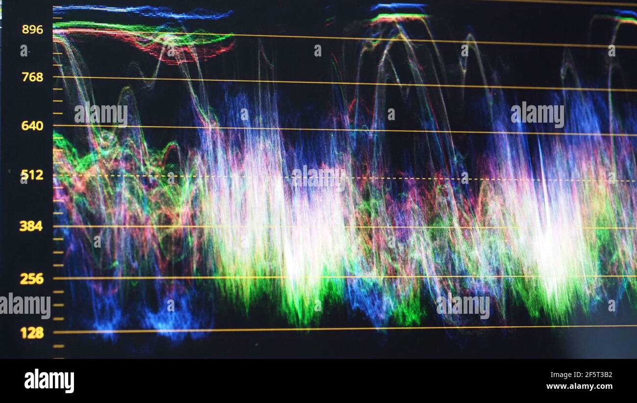 Monitor di classificazione dei colori. Grafico dell'indicatore di correzione del colore RGB sullo schermo durante il processo di post-produzione. Fase di telecine in processi di produzione di video o film Foto Stock
