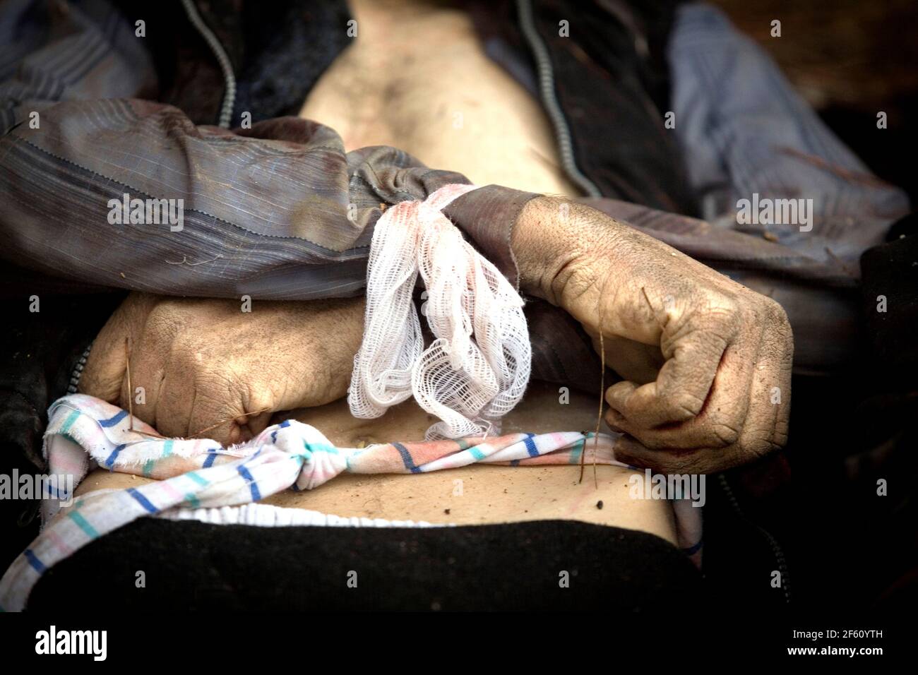 Le mani legate di un uomo morto trovato in una tomba di massa nel terreno di una scuola nel sobborgo orientale di Damasco di Sakba. I locali dicono di non essere stati in grado di seppellire i morti uccisi durante un assalto da parte delle forze governative nel tentativo di riportare la zona dall'esercito siriano libero. Le proteste contro il regime al governo baathista di Bashar al-Assad sono scoppiate nel marzo 2011. Anche se inizialmente erano pacifici, sono stati repressi violentemente dall'esercito e dalla polizia siriani. In risposta all'ordine di sparare a civili disarmati, un gran numero di uomini disertò l'esercito e formò l'Esercito siriano libero. La protesta Foto Stock