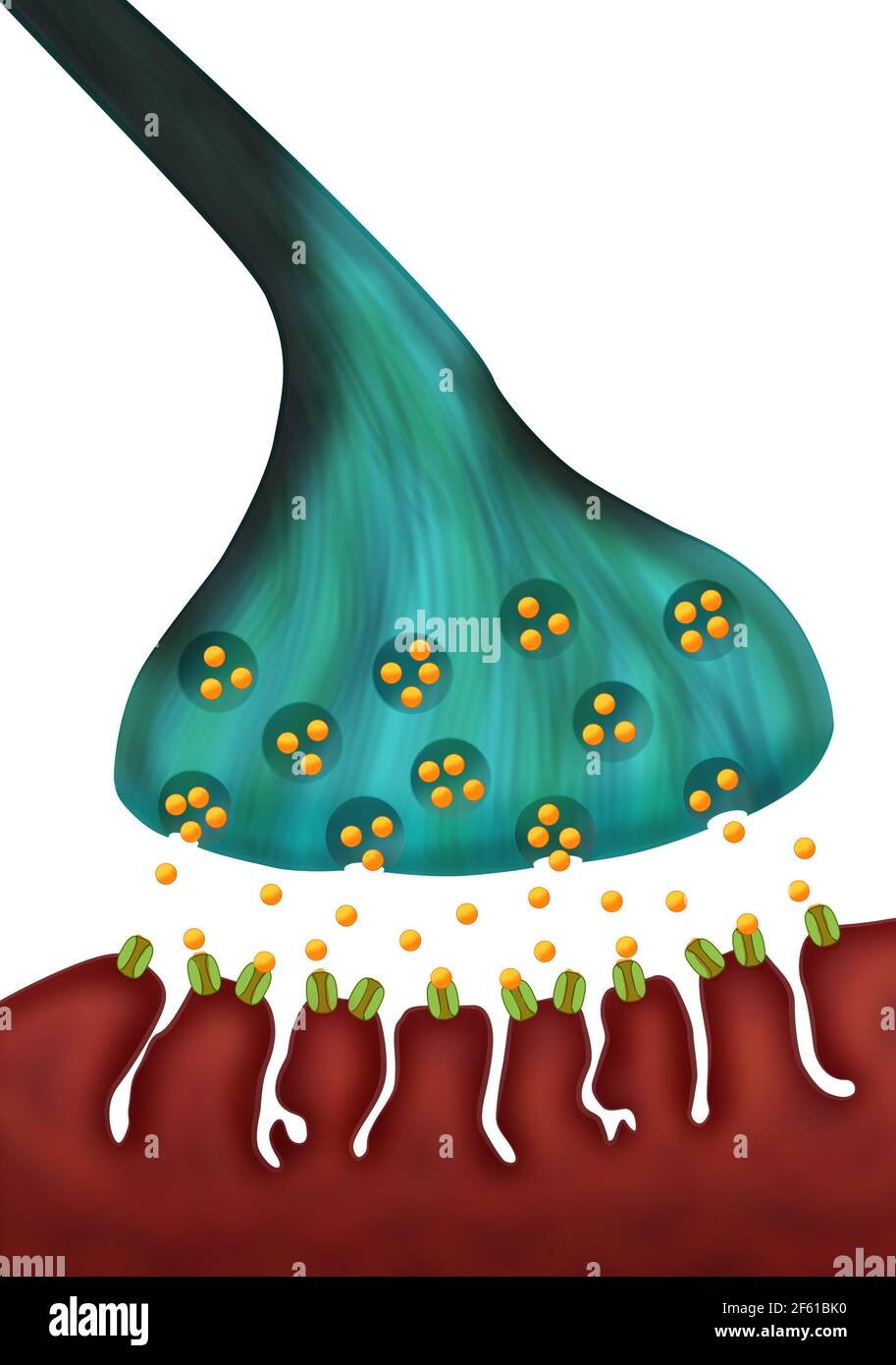 La Miastenia grave Foto Stock