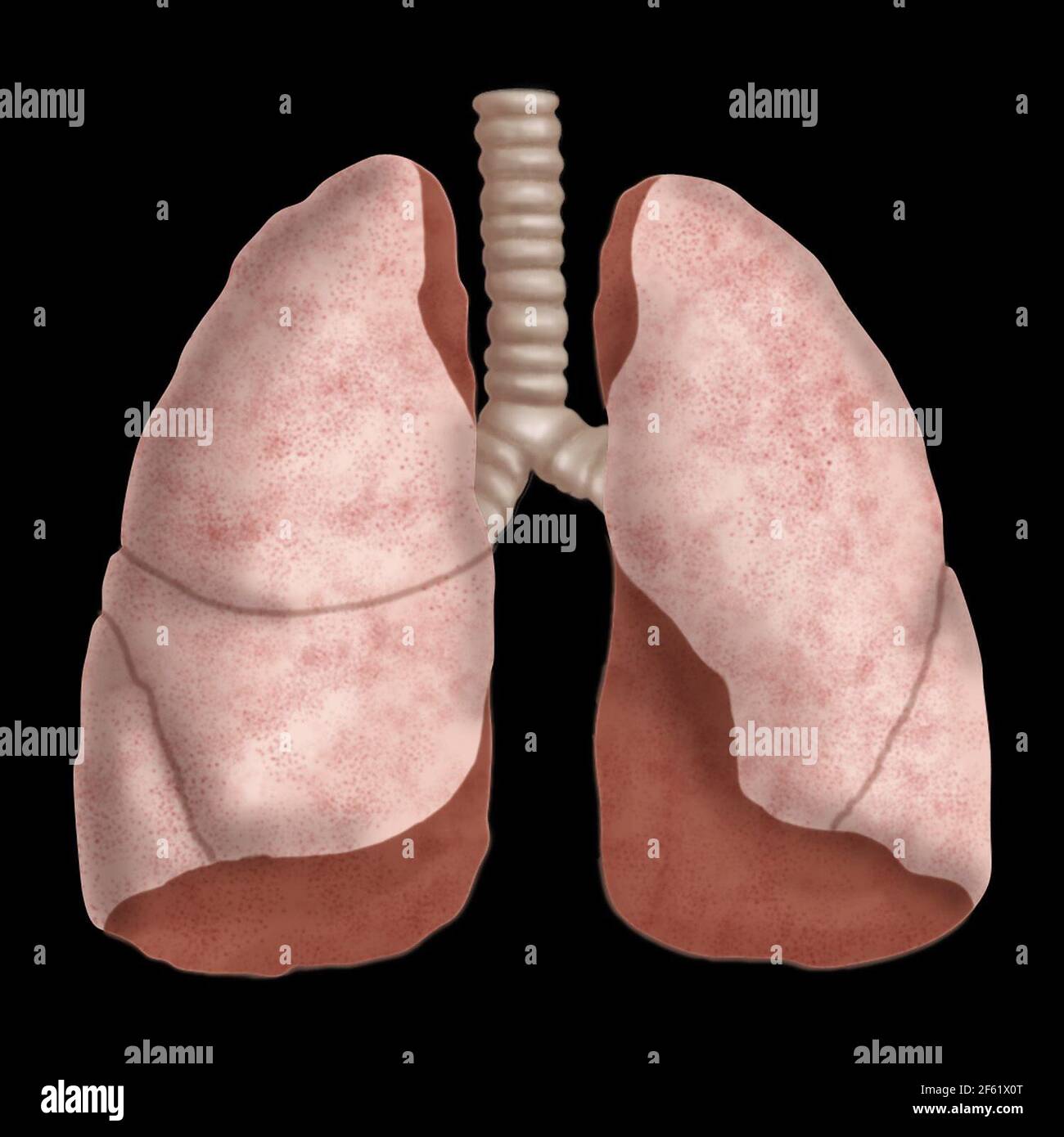 Illustrazione dei polmoni umani Foto Stock