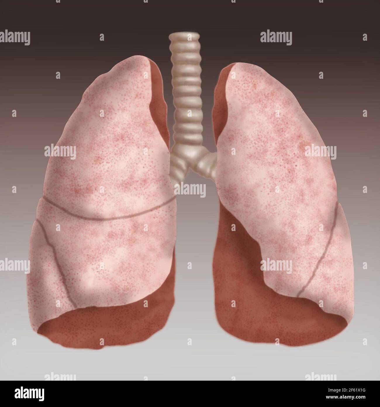 Illustrazione dei polmoni umani Foto Stock