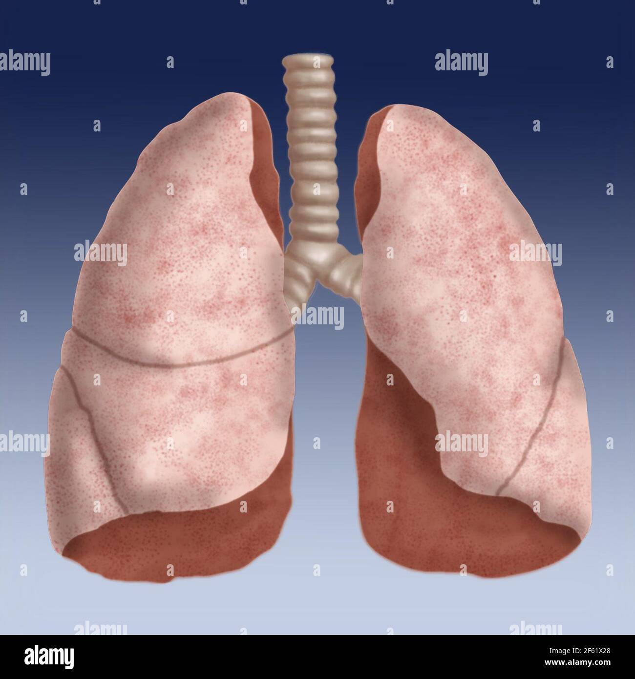 Illustrazione dei polmoni umani Foto Stock
