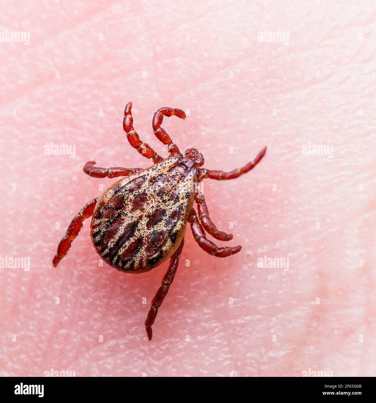 Virus encefalite o malattia di Lyme borreliosi infetto Tick Arachnid Insect Strisciare sulla pelle Foto Stock