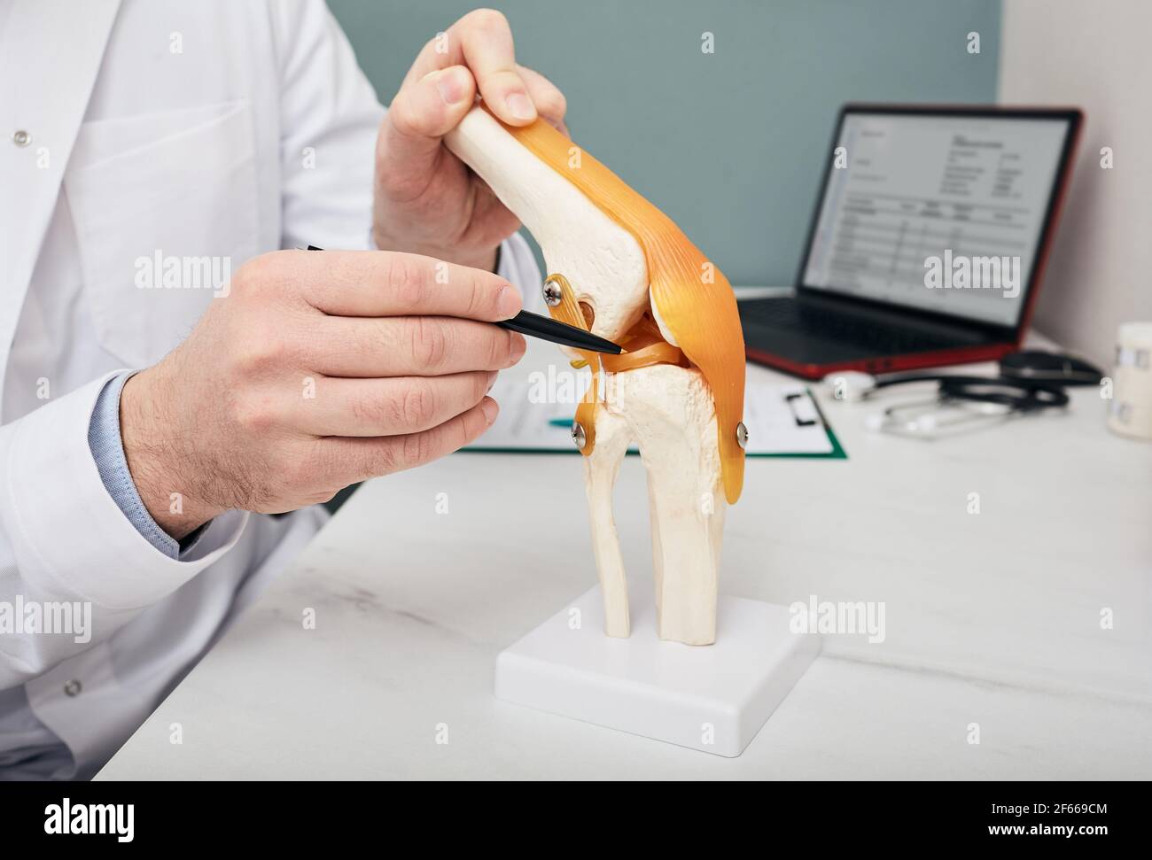 Traumatologo che punta la penna al menisco in un modello di insegnamento anatomico delle articolazioni del ginocchio, primo piano. Concetto di trattamento del menisco strappato umano Foto Stock
