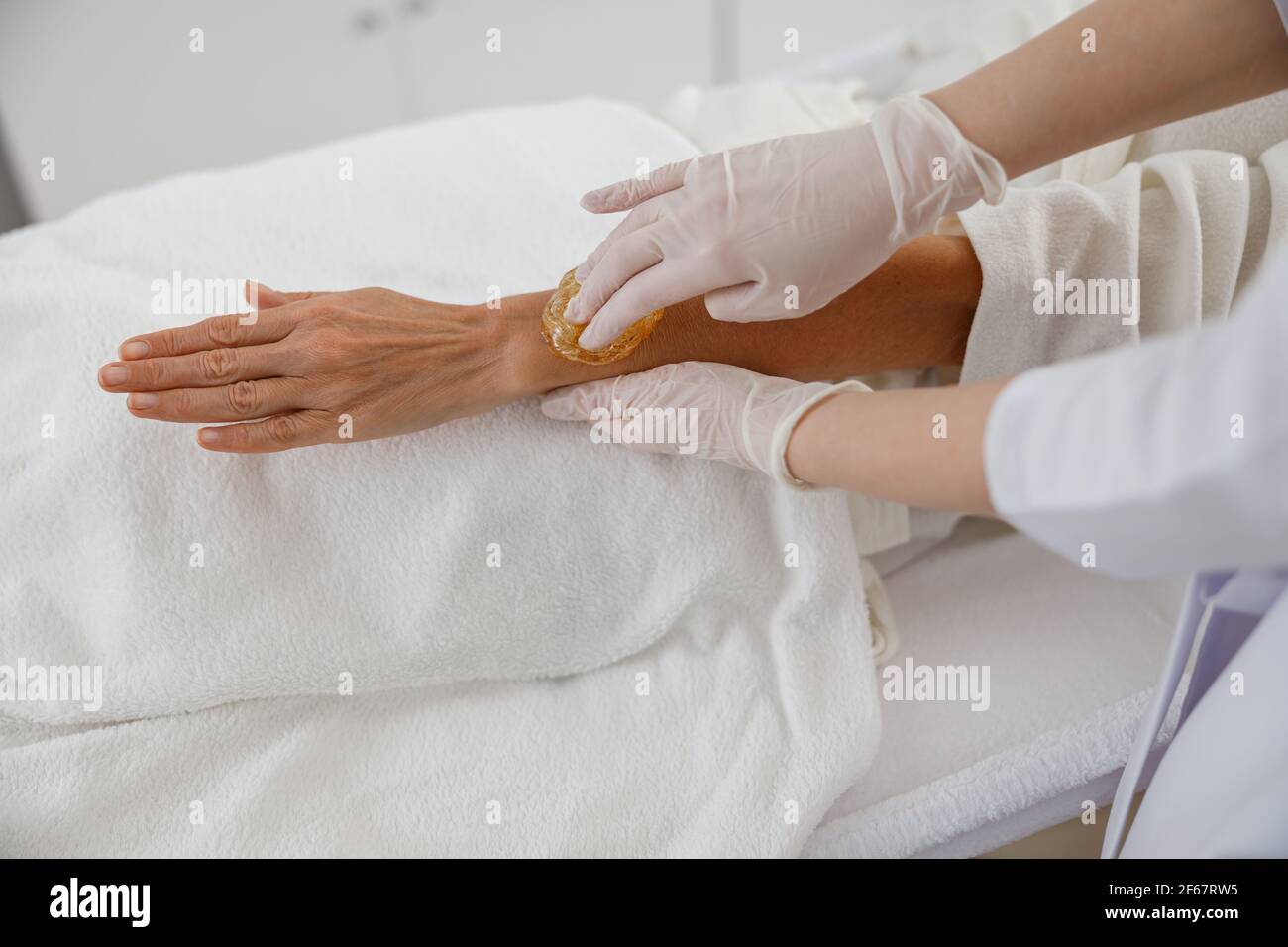 Zuccheratura con materiali naturali. Il medico mette cera, miele. Concetto di medicina, strumenti medici, assistenza sanitaria, industria di bellezza, rimozione dei capelli Foto Stock