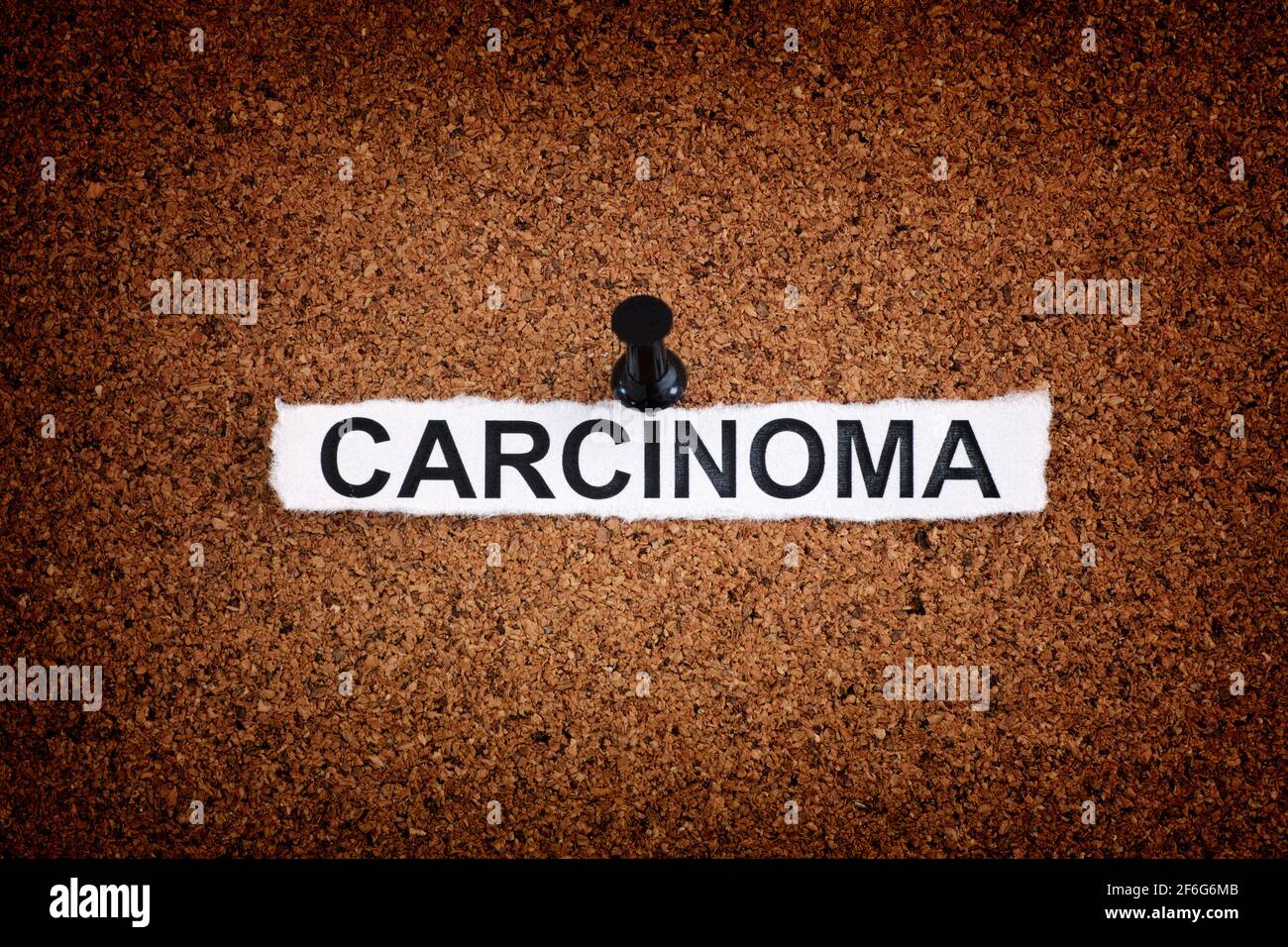 Carcinoma. Pezzo di carta strappato con la parola Carcinoma inchiodato su un pannello di sughero. Primo piano. Foto Stock