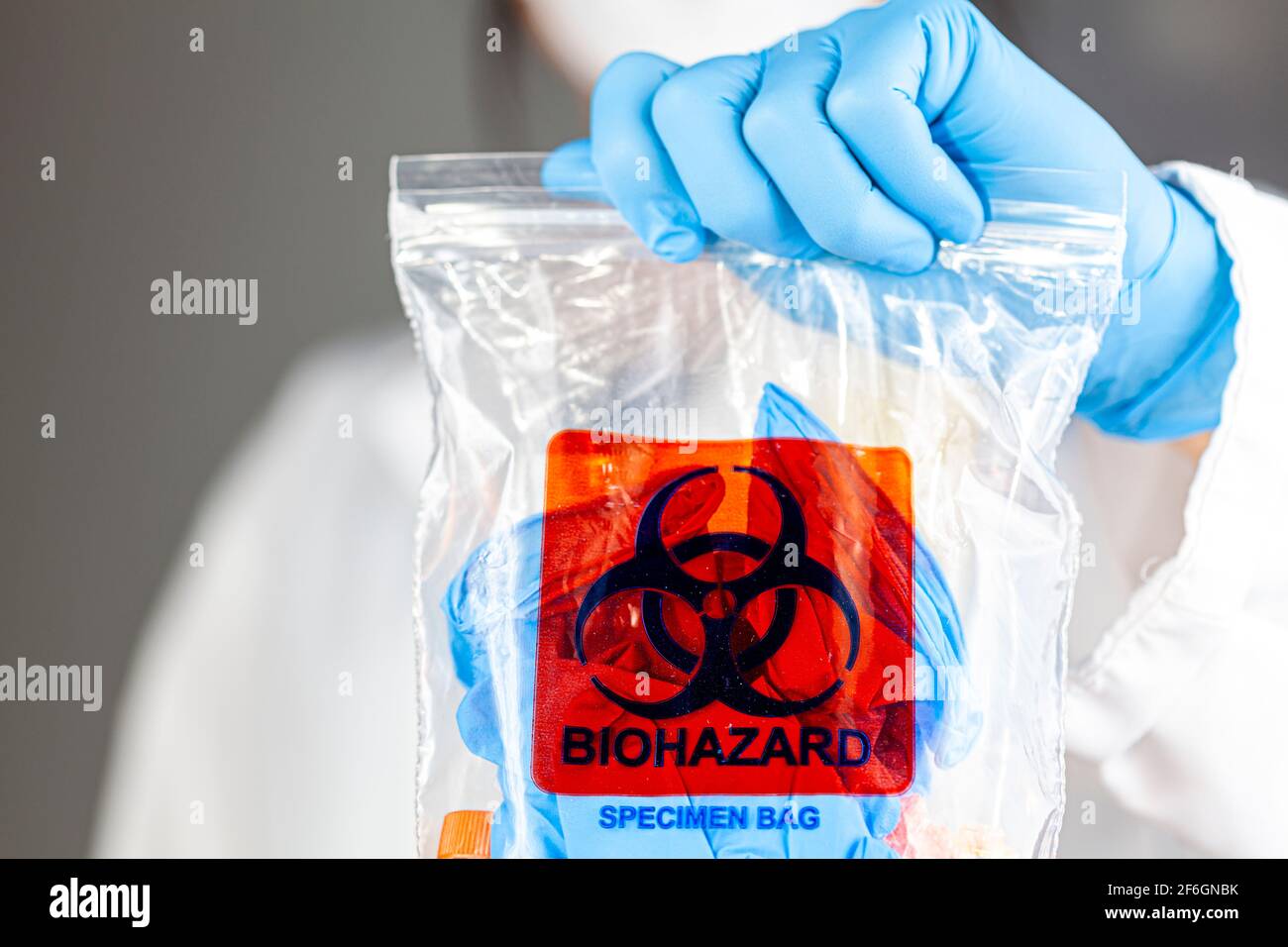 Una donna ricercatrice sta tenendo un sacchetto di plastica trasparente con il logo del rischio biologico stampato sopra. Il sacchetto contiene campioni biologici potenzialmente pericolosi. Scient Foto Stock