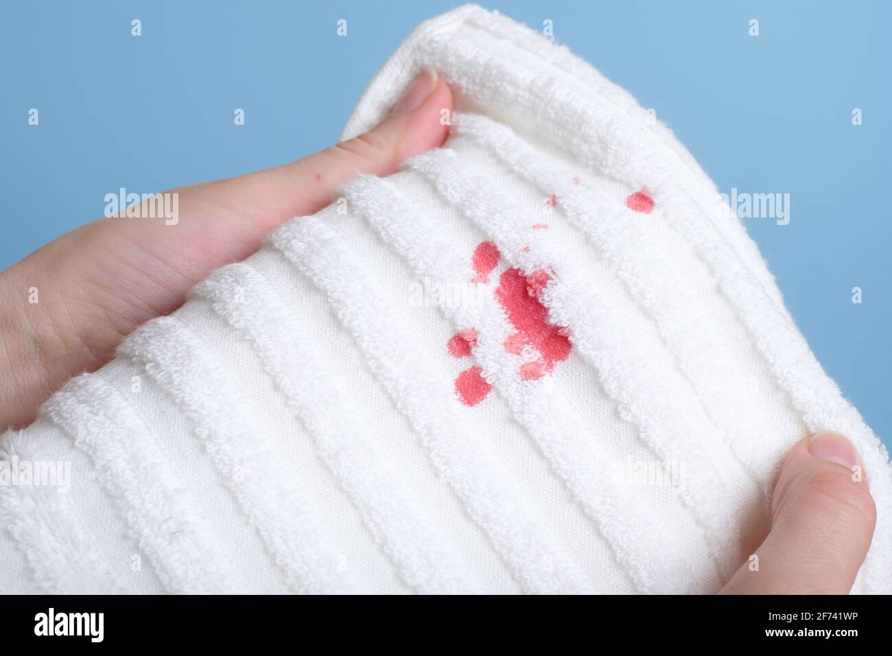 macchie di sangue su un asciugamano bianco. la vita quotidiana macchia sporca per il lavaggio e pulizia concetto Foto Stock
