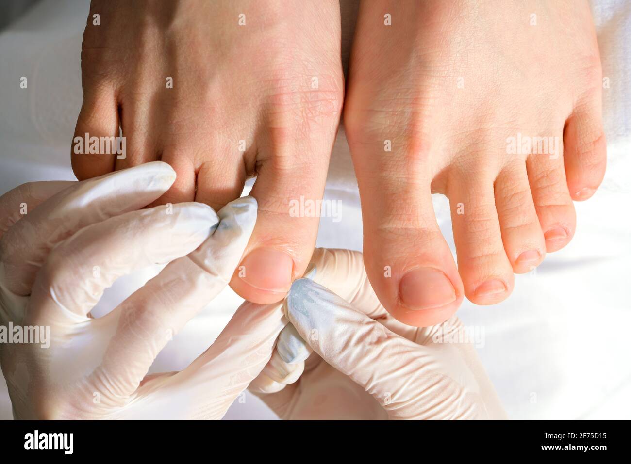 Un medico di podiatrist che si prende cura delle toenails di una donna. Procedure cosmetiche dei piedi Foto Stock