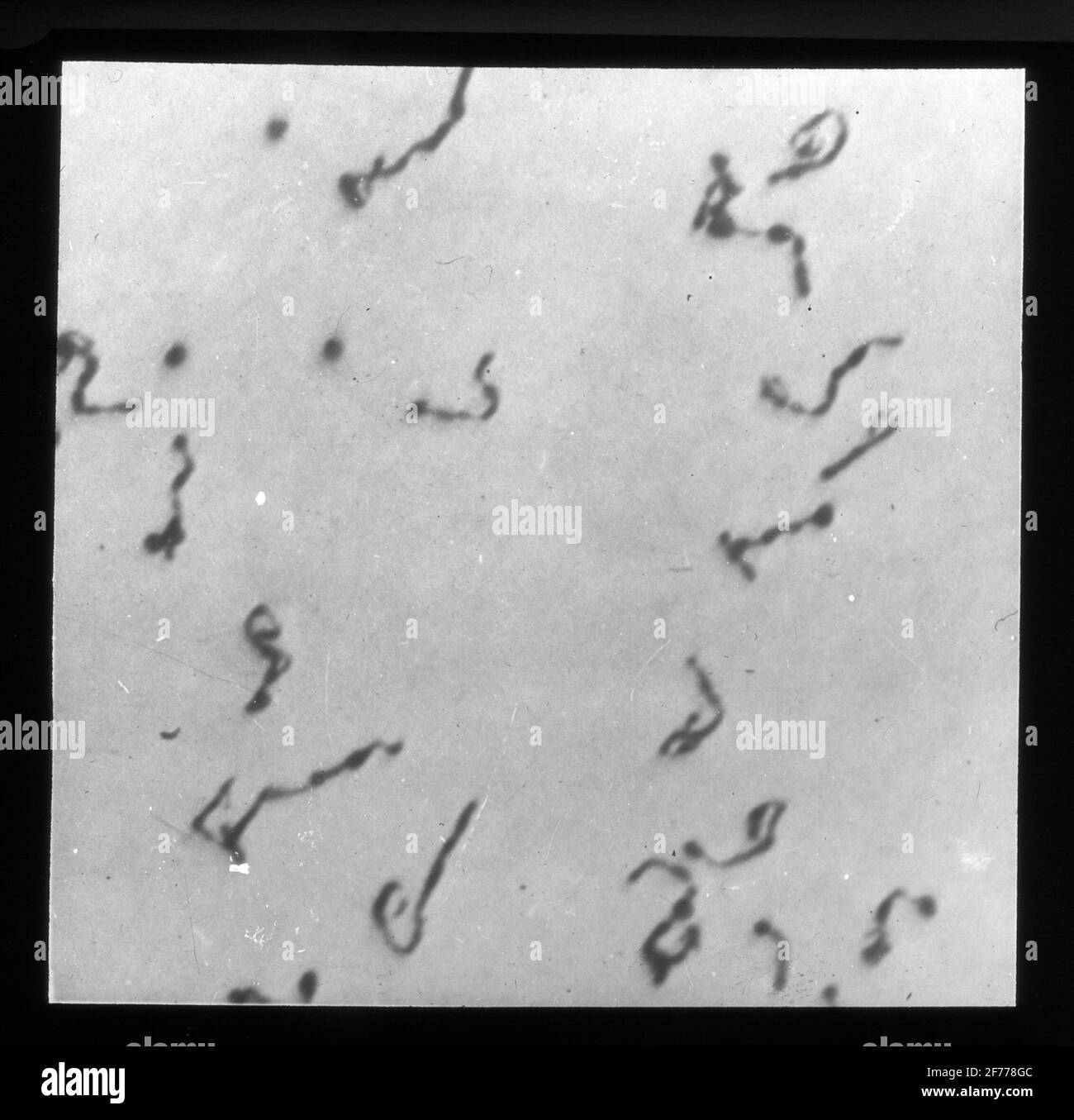 Immagine Skiopticon del Dipartimento di Fotografia del Royal Institute of Technology. Utilizzo da parte del professor Helmer Bäckström come materiale didattico. Bäckström è stato il primo professore svedese di fotografia al Royal Institute of Technology di Stoccolma 1948-1958.Mikro Fotografia di cellule madri di polline. Eventualmente fotografato in luce ultravioletta. Per ulteriori informazioni, vedere: Bäckström, Helmer. Manuale fotografico. Altra edizione rivista. Natura e Cultura. Stoccolma. 1948. pag. 1217. Foto Stock