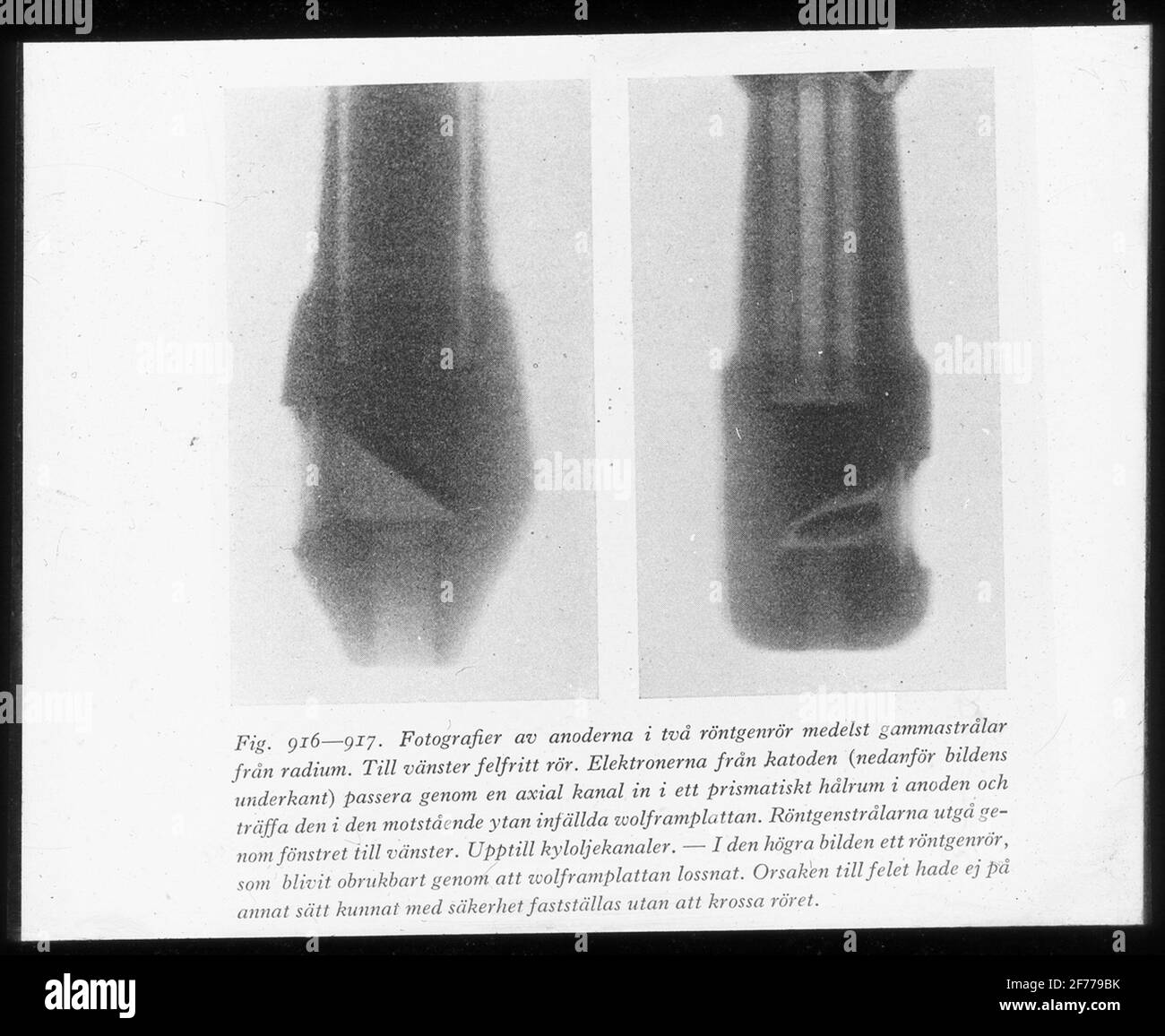 Immagine Skiopticon del Dipartimento di Fotografia del Royal Institute of Technology. Utilizzo da parte del professor Helmer Bäckström come materiale didattico. Bäckström è stato il primo professore svedese di fotografia al Royal Institute of Technology di Stoccolma 1948-1958. Fotografie degli anodi in due raggi X da raggi gamma da radium. A sinistra tubo impeccabile. A destra, il tubo radiogeno è diventato inutilizzabile quando la piastra Wolut si losisce. Per ulteriori informazioni, vedere: Bäckström, Helmer. Manuale fotografico. Natura e Cultura. Stoccolma. 1942. pag. 891. Foto Stock