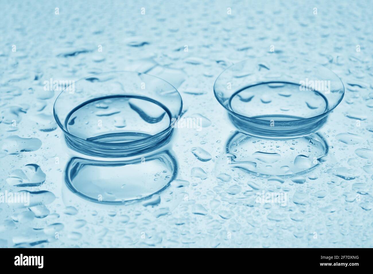 Primo piano di due lenti a contatto morbide con riflessi su sfondo azzurro con gocce. Foto Stock