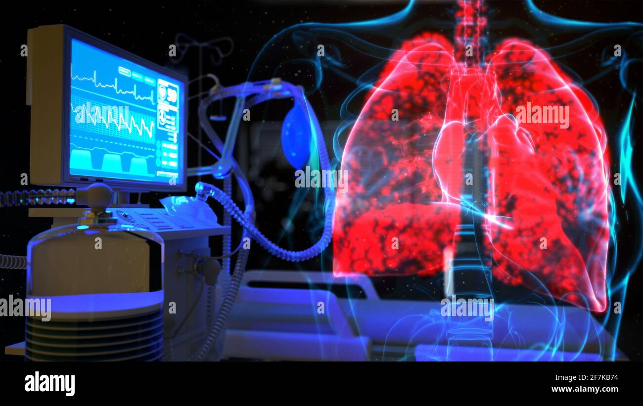 Ventilatore polmonare umano e per terapia intensiva, illustrazione 3d cg  Healthcare Foto stock - Alamy