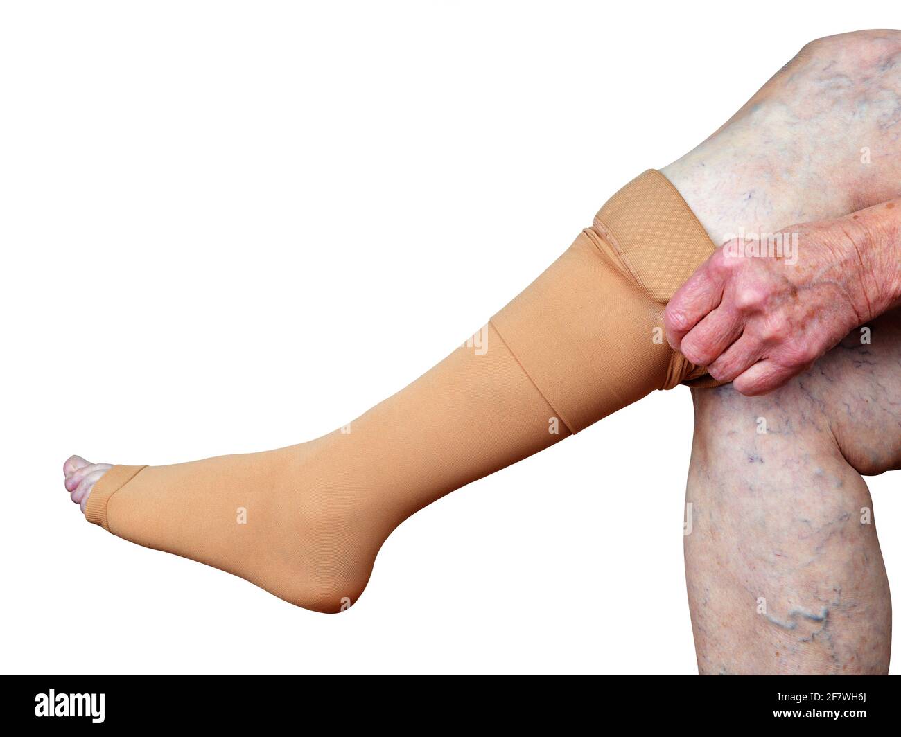 Calze di trombosi su una gamba di vecchia donna isolato su sfondo bianco  Foto stock - Alamy