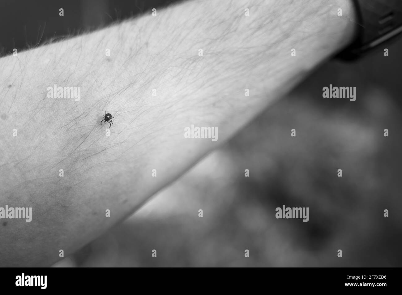 Un segno di spunta di stella solita, un vettore comune di malattie, strisciando su un braccio Foto Stock