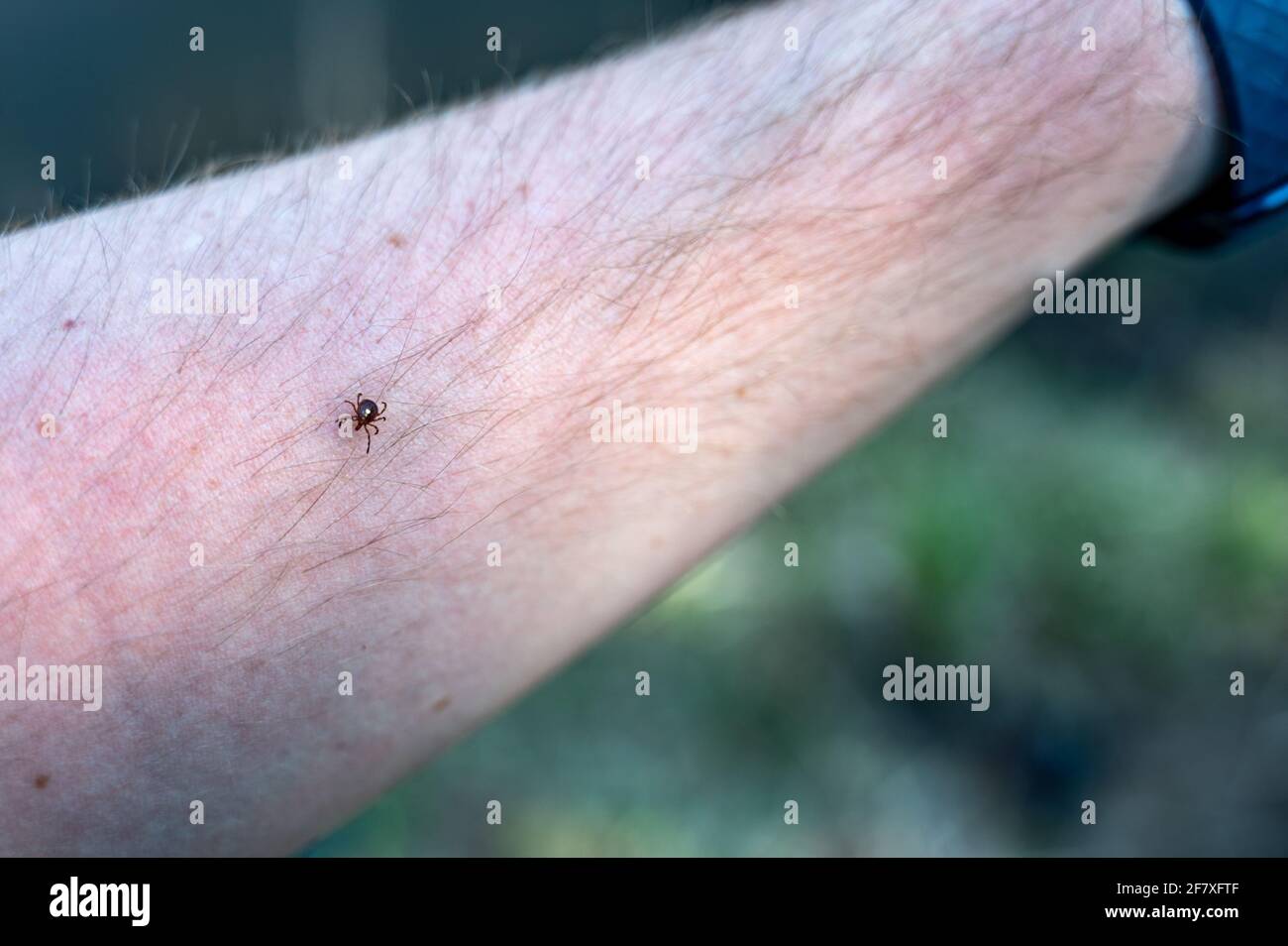 Un segno di spunta di stella solita, un vettore comune di malattie, strisciando su un braccio Foto Stock