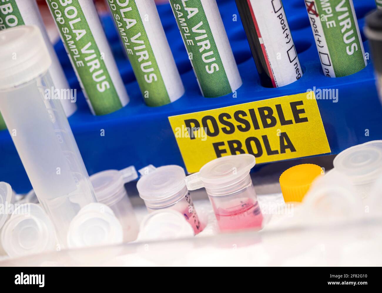 Campione di sangue da paziente Ebola, risultato positivo, immagine concettuale Foto Stock