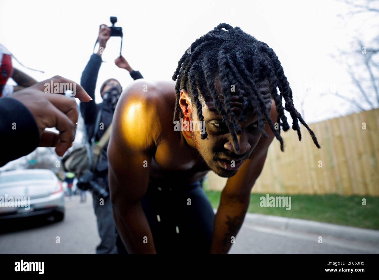 Un uomo che è stato girato in testa con una pallottola di gomma è fotografato durante una protesta dopo che la polizia ha presumibilmente sparato e ucciso un uomo, a Brooklyn Center, Minnesota, Stati Uniti, aprile 11, 2021. REUTERS/Nick Pfosi Foto Stock