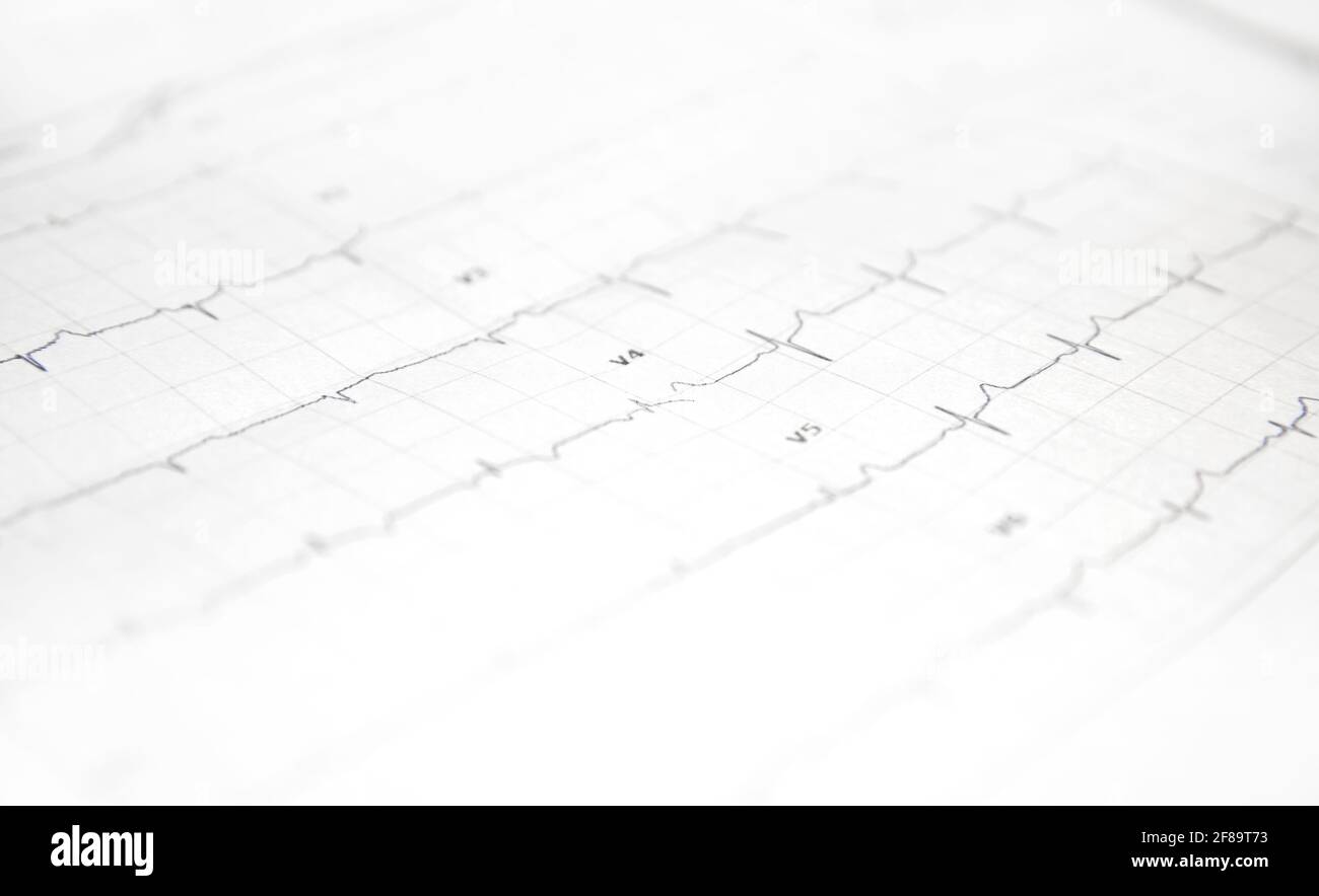 una scheda con un cardiogramma del cuore. Foto Stock