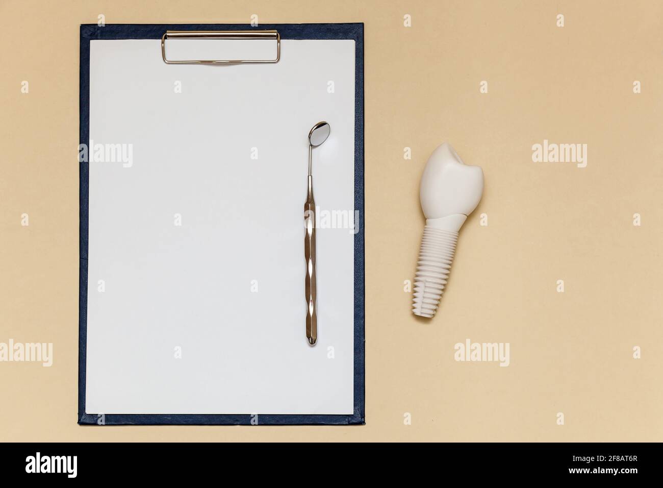 Impianto dentale e piegatrice con clip per fogli di carta A4 su sfondo beige. Modello di impianto dentale del dente artificiale. Concetto di odontoiatria e medicina Foto Stock