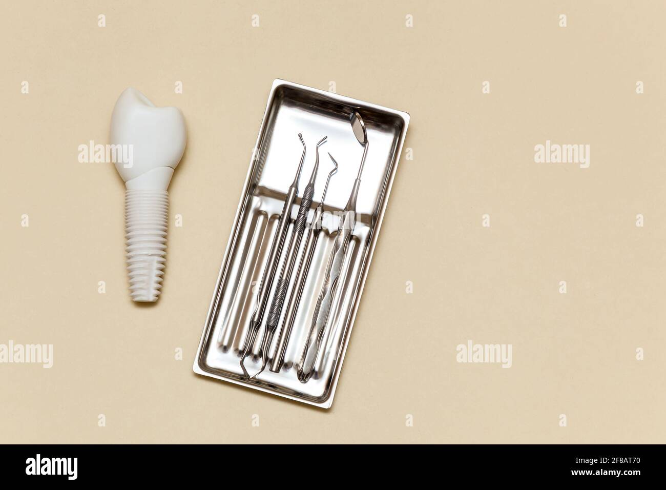 Impianto dentale, utensili dentali su fondo beige. Modello di impianto dentale del dente artificiale. Concetto di odontoiatria e strumenti medici. Foto con Foto Stock