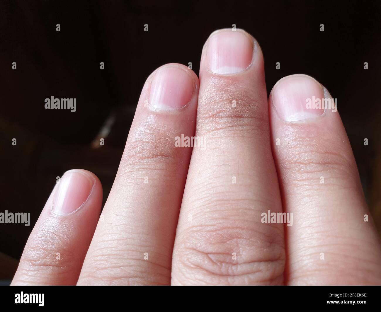 Quattro dita di una mano e unghie in modo elegante foto per quanto riguarda l'assistenza sanitaria Foto Stock