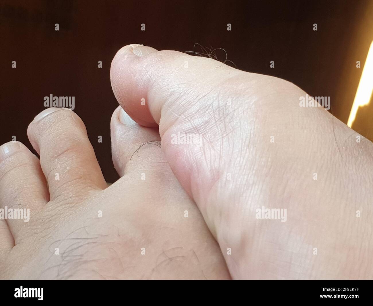 Una vista della parte del piede umano è chiaramente visibile nel telaio per scopi sanitari Foto Stock