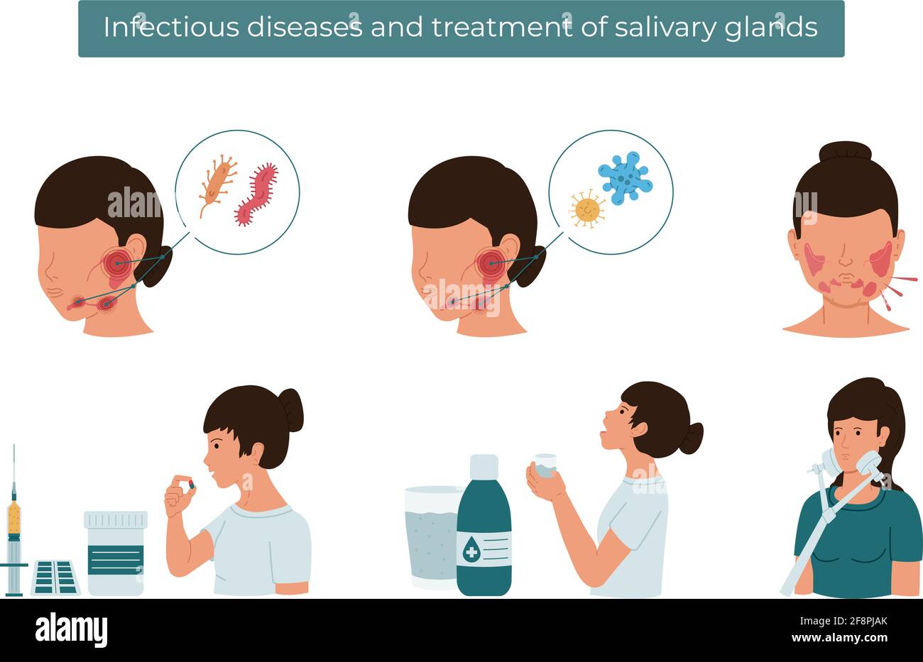 Illustrazione piatta del vettore delle malattie infettive e trattamento della ghiandola salivare. Illustrazione Vettoriale