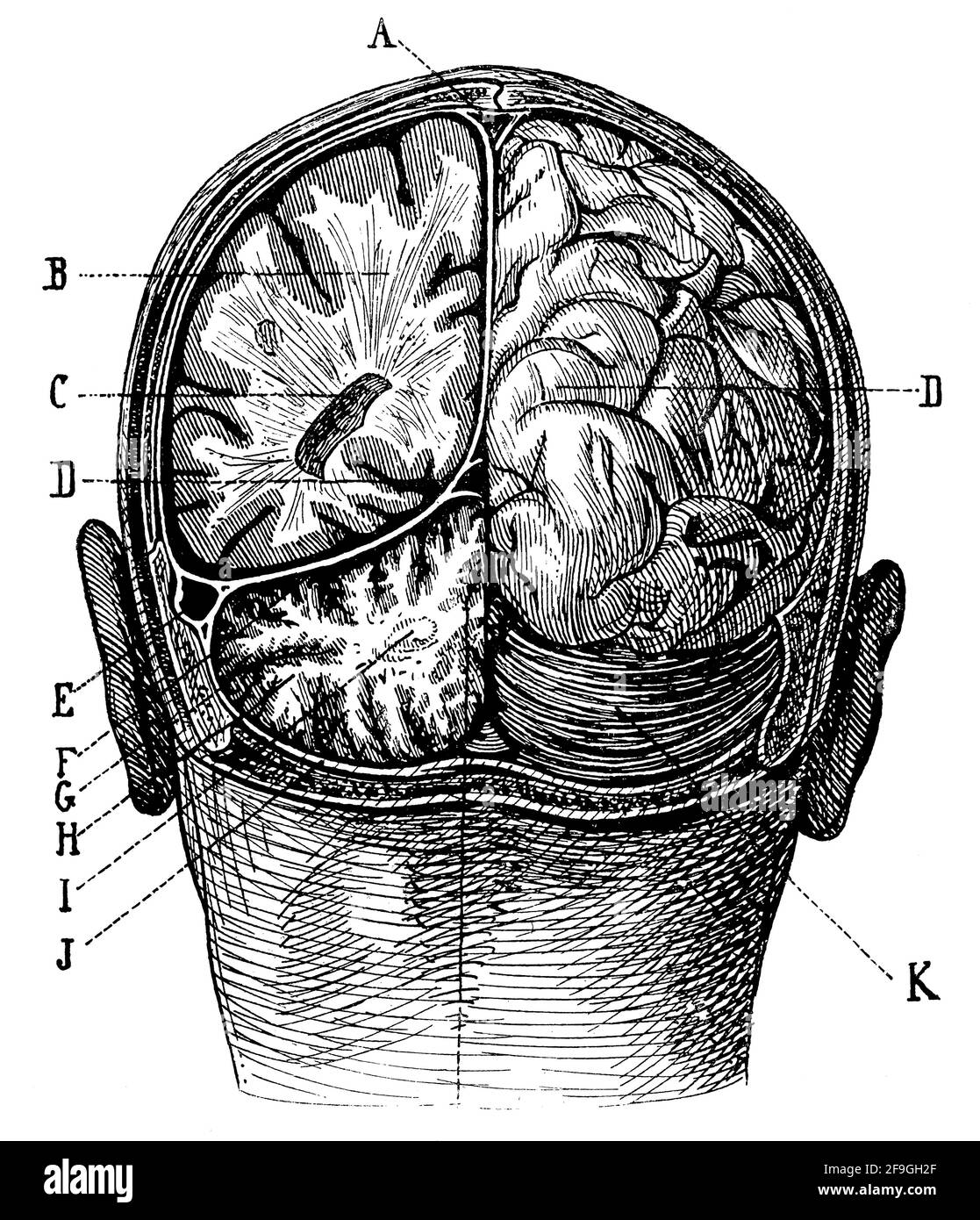 Cranio: Posizione del cervo e del cervelletto nella cavità cranica. Illustrazione del 19 ° secolo. Germania. Sfondo bianco. Foto Stock