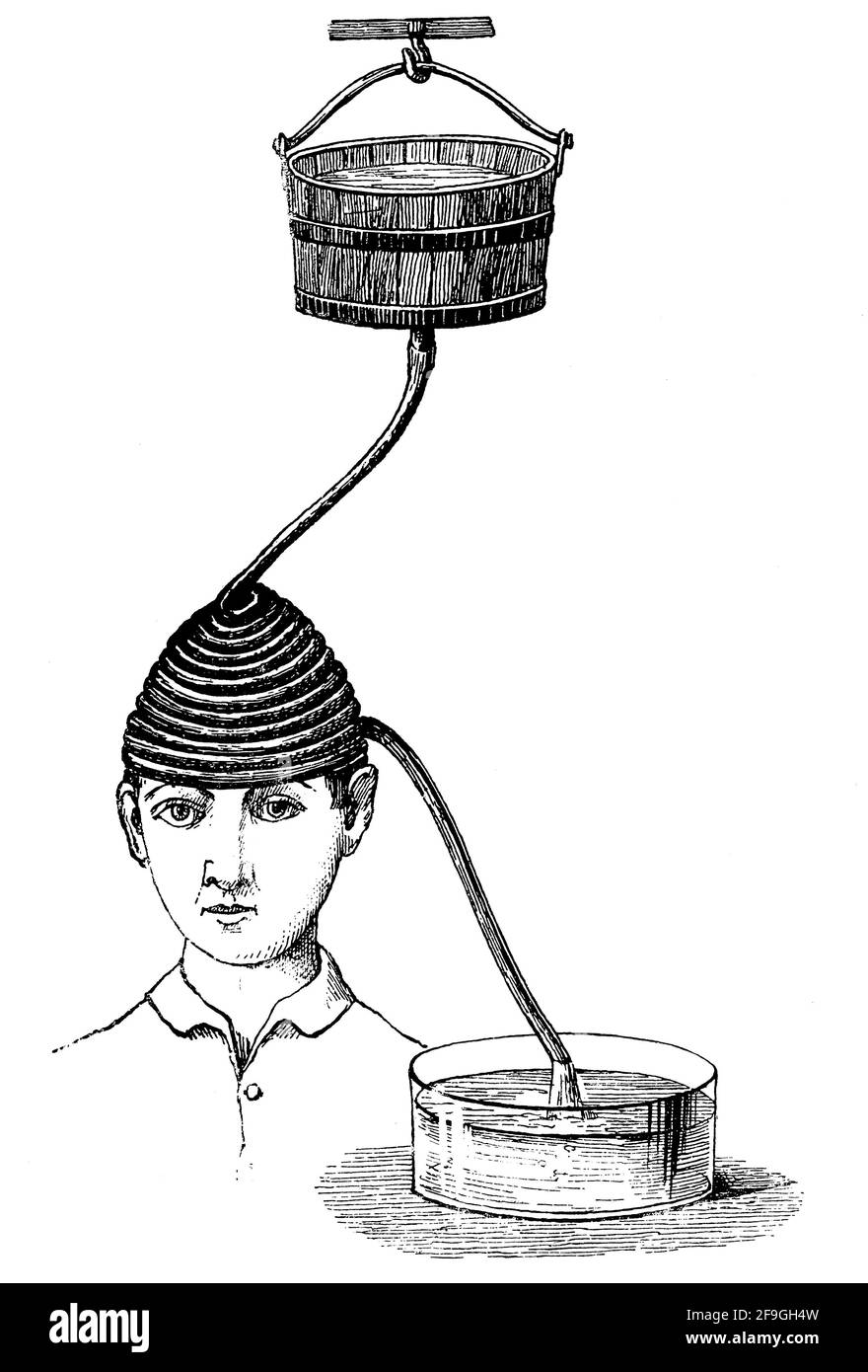 Trattamento con acqua fredda per mal di testa persistenti. Illustrazione del 19 ° secolo. Germania. Sfondo bianco. Foto Stock