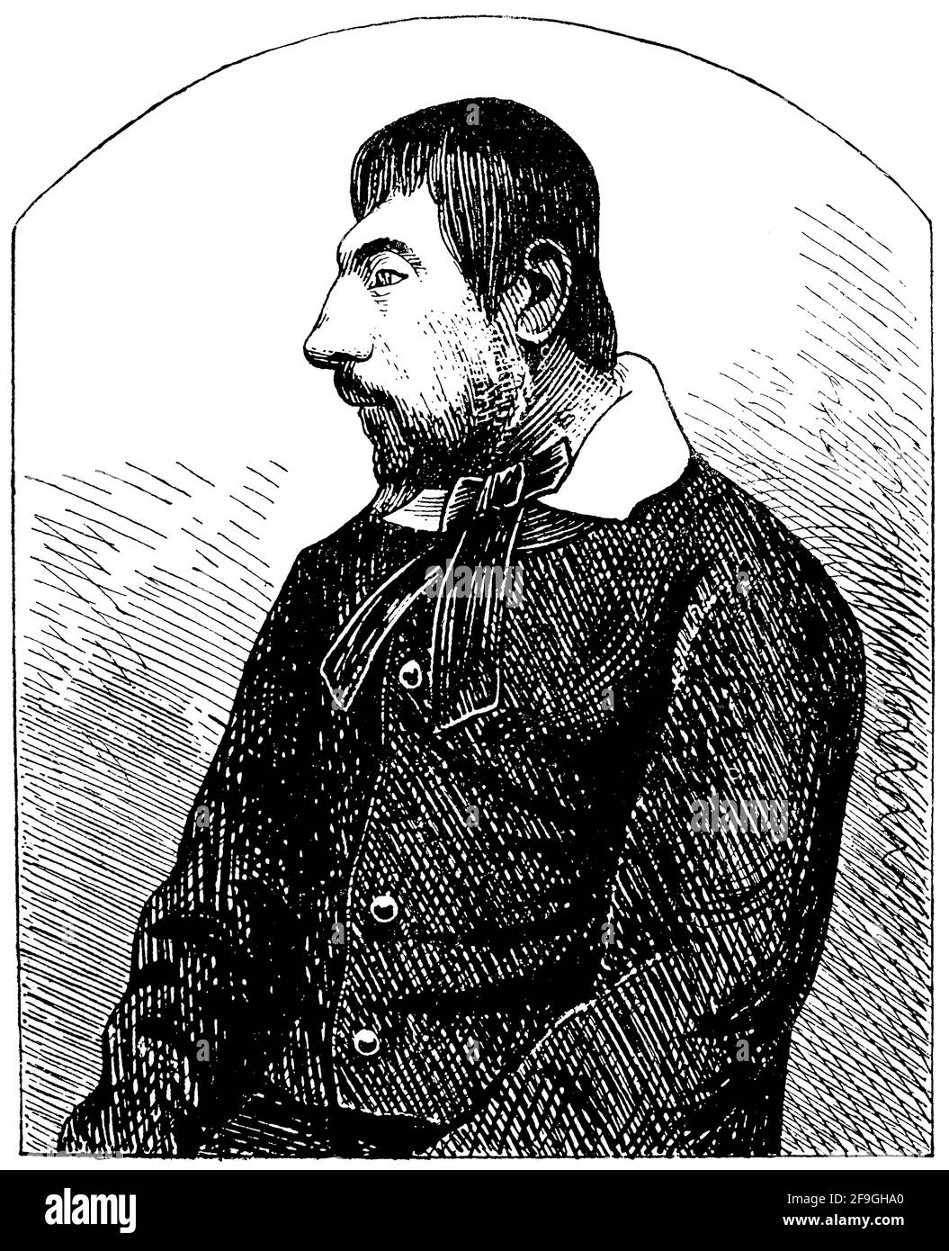 Ritratto di un uomo con malattia mentale (Idiot). Illustrazione del 19 ° secolo. Germania. Sfondo bianco. Foto Stock