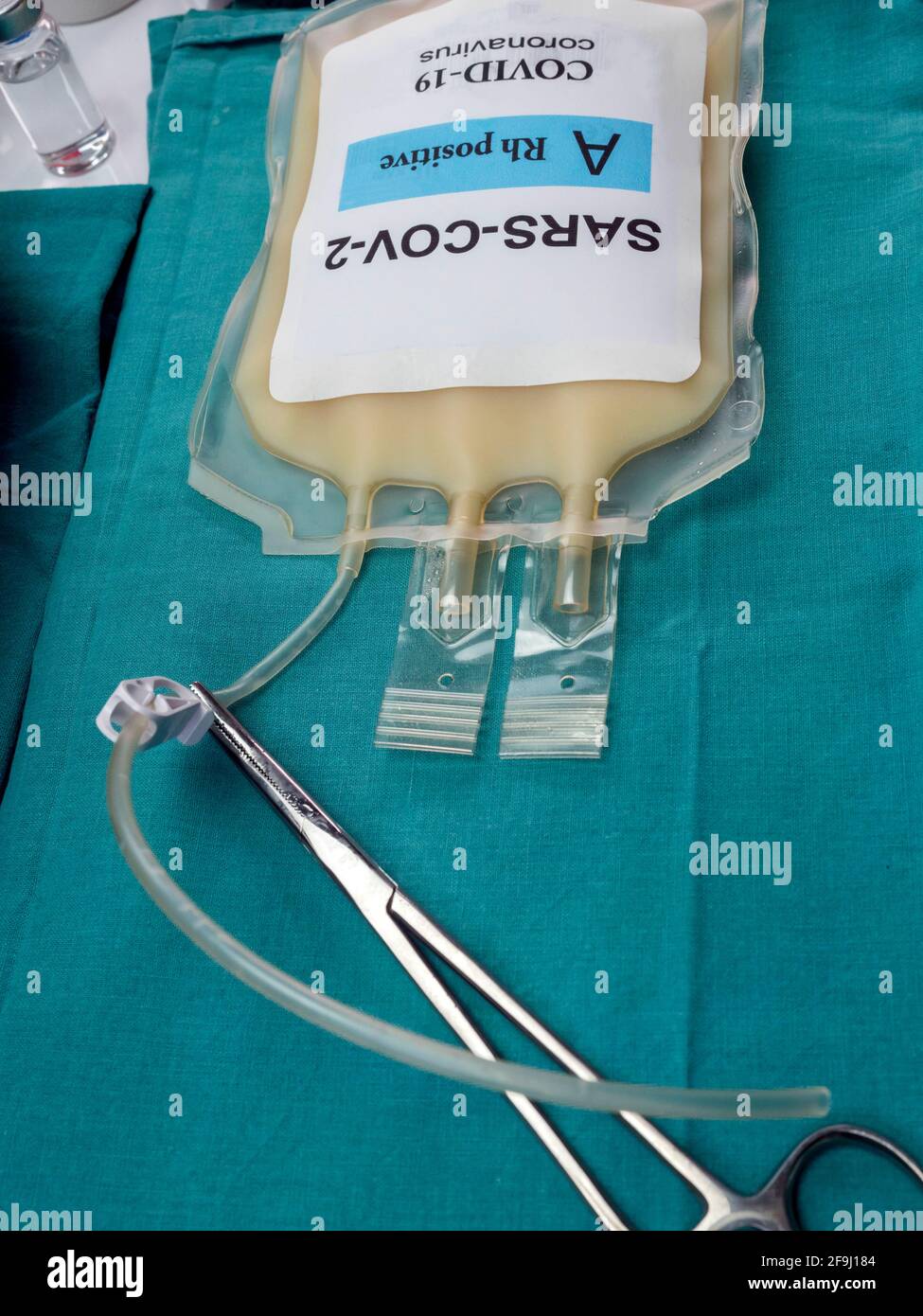 Sacca per plasma con anticorpi da persone curate di SARS-COV-2 Covid-19 preparata in un'immagine concettuale ospedaliera Foto Stock