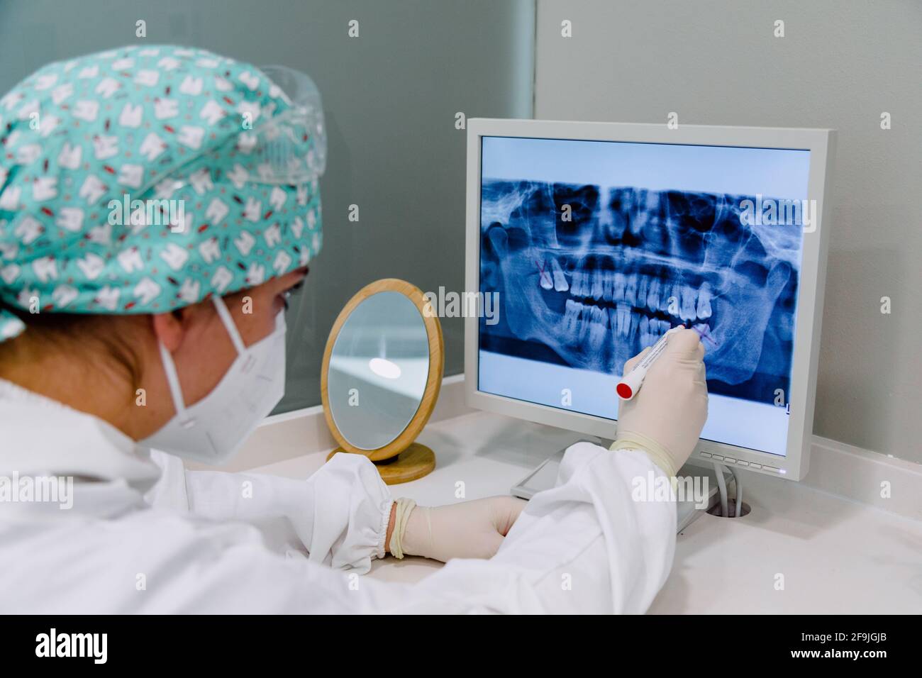 Dentista femminile con un radiografia sul computer che indica i molari da estrarre Foto Stock