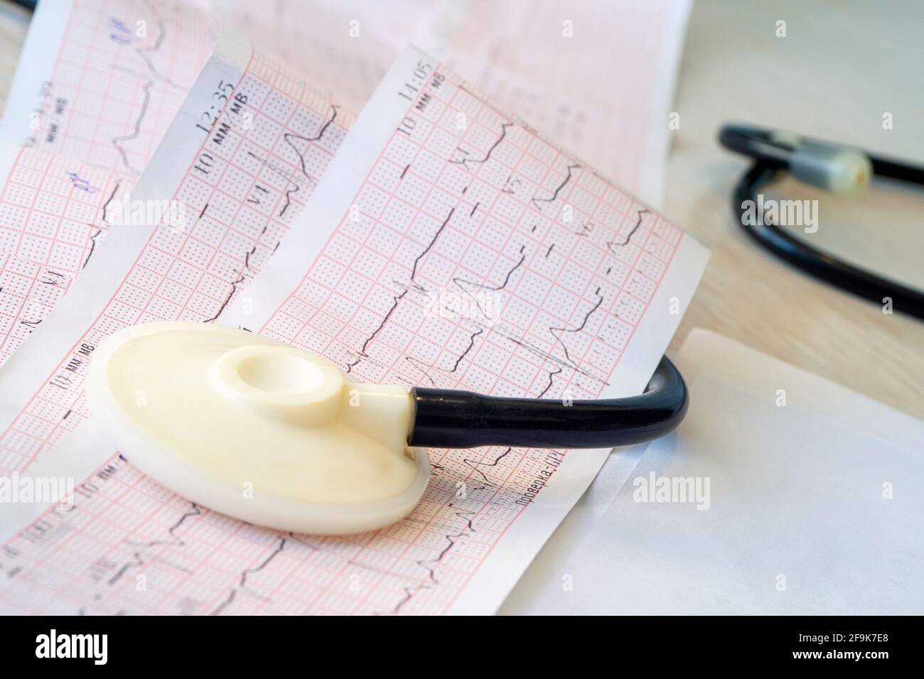 Strumento per la testa dello stetoscopio poggiato sul cardiogramma agganciato al closeup dell'imbottitura. Il concetto di malattie cardiache e prevenzione degli attacchi cardiaci. Esame medico profilattico Foto Stock