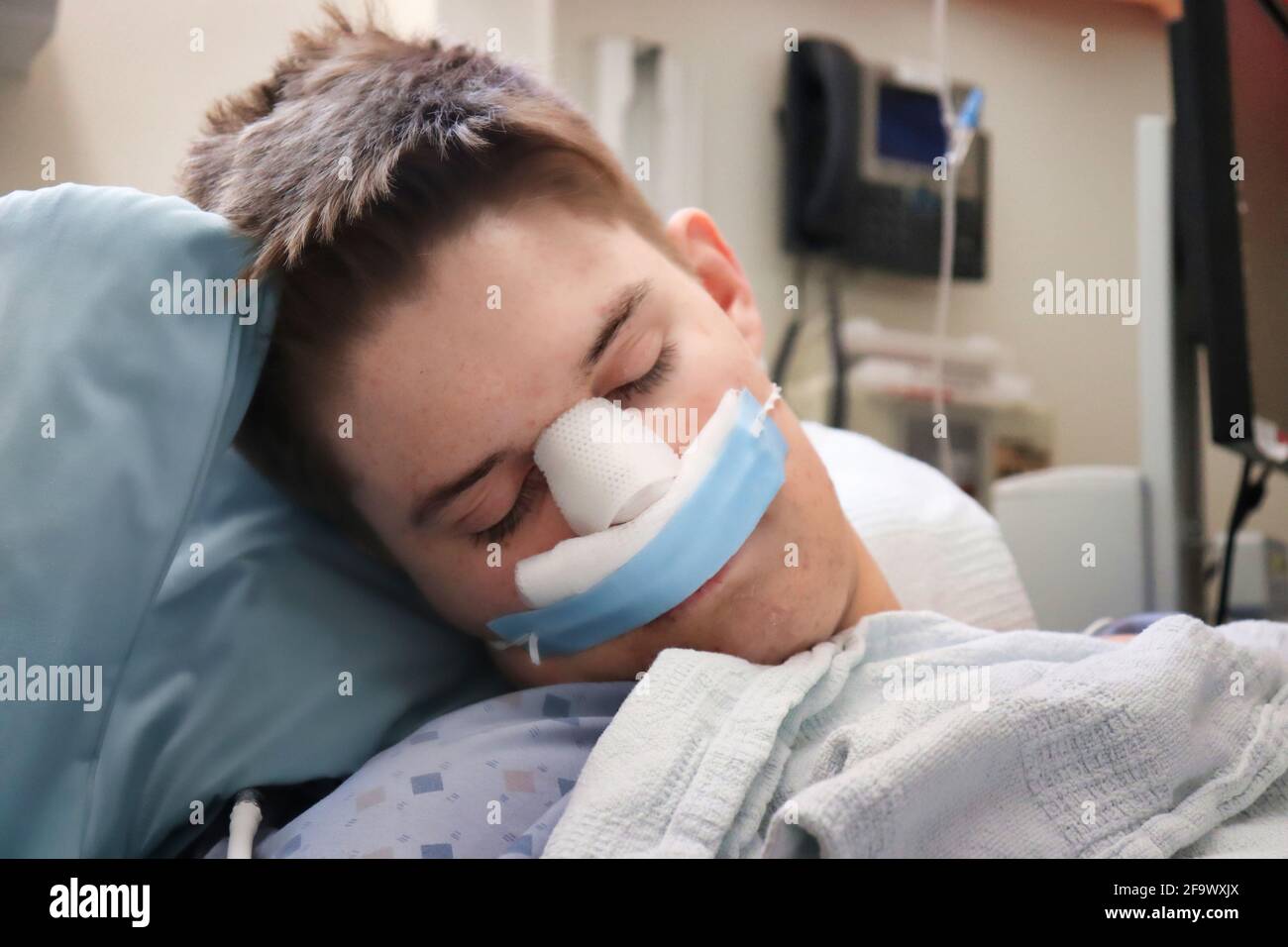 Primo piano del viso e delle bende di un ragazzo adolescente dopo un intervento chirurgico al naso. Foto Stock