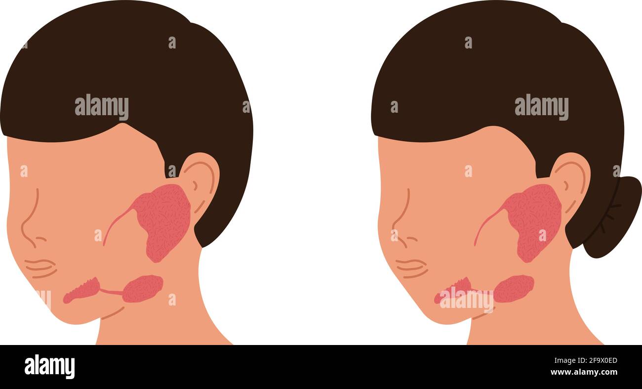 Localizzazione di ghiandole salivari in maschi e femmine. Illustrazione del vettore medico. Illustrazione Vettoriale