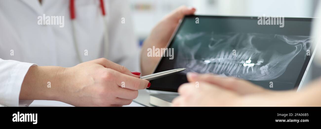 Dentista che mostra la compressa del paziente con raggi X dei denti in clinica primo piano Foto Stock