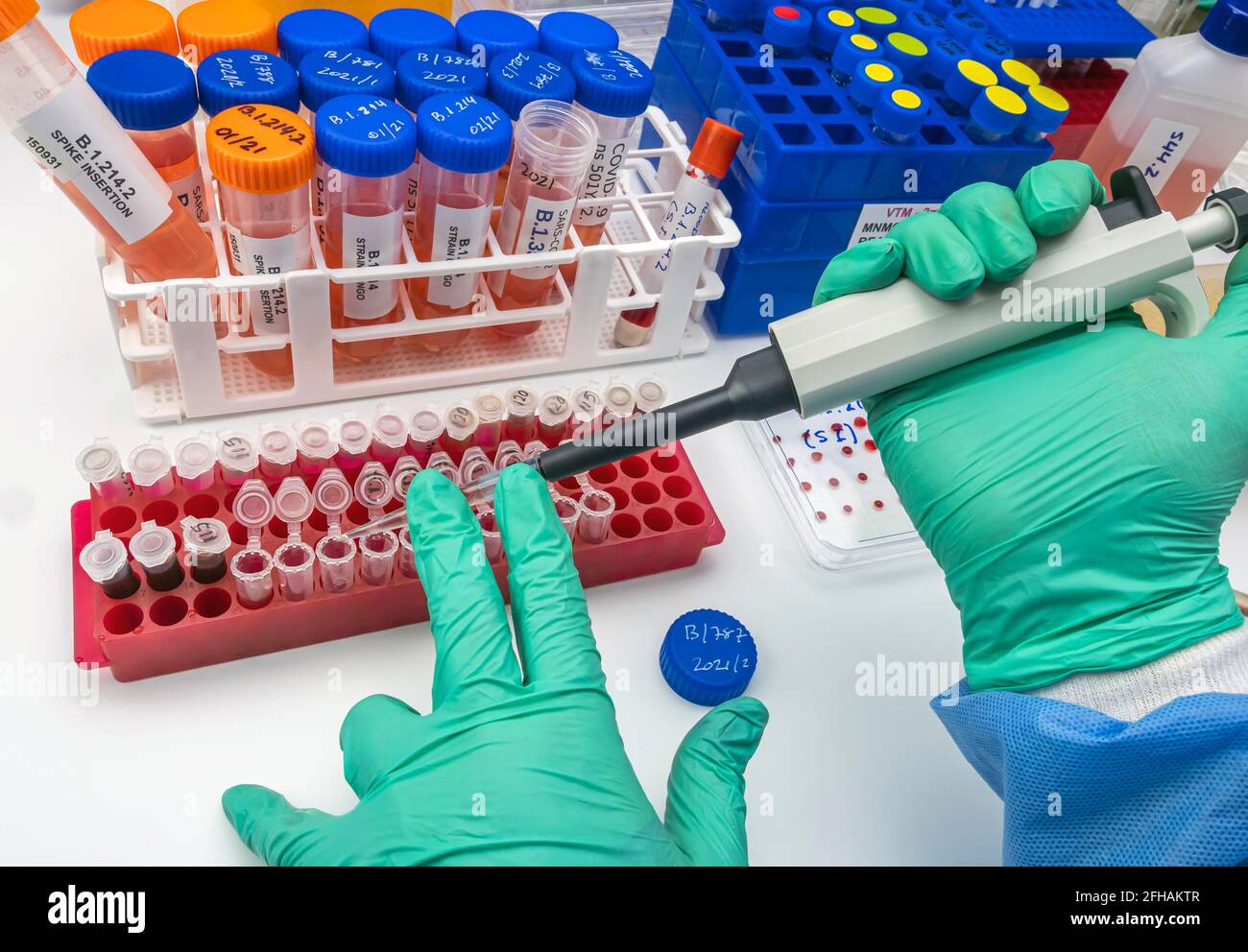 Analisi di laboratorio di una nuova mutazione Sars-Cov-2 in Belgio dal Congo, nota come Spike Insertion (si) il cui nome scientifico è B.1.214, ima concettuale Foto Stock